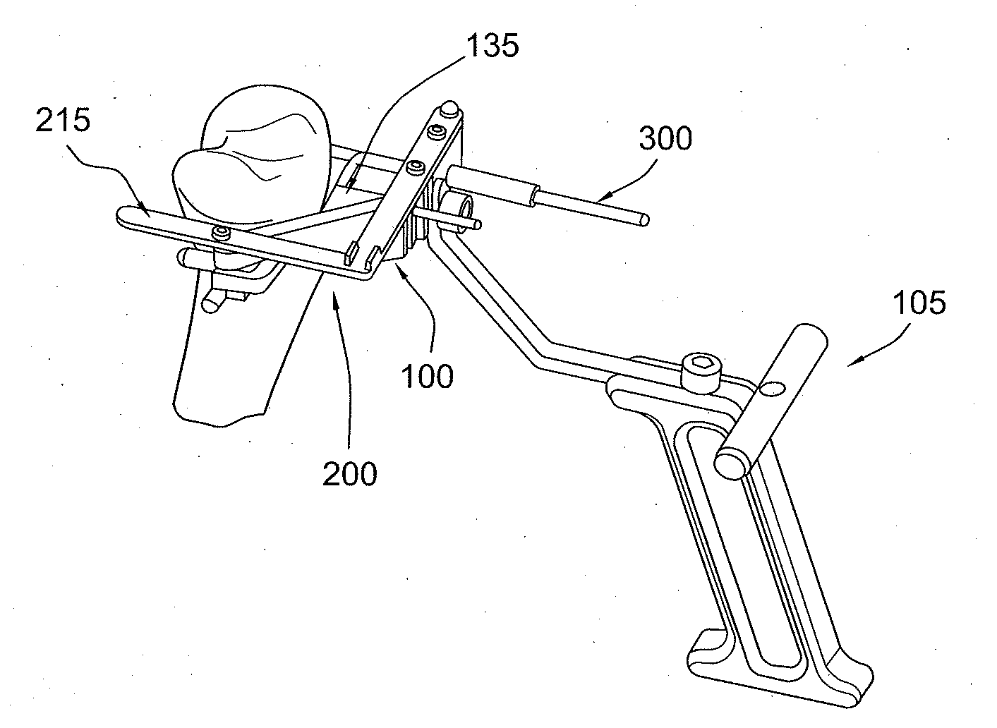 Method and apparatus for performing an open wedge, high tibial osteotomy