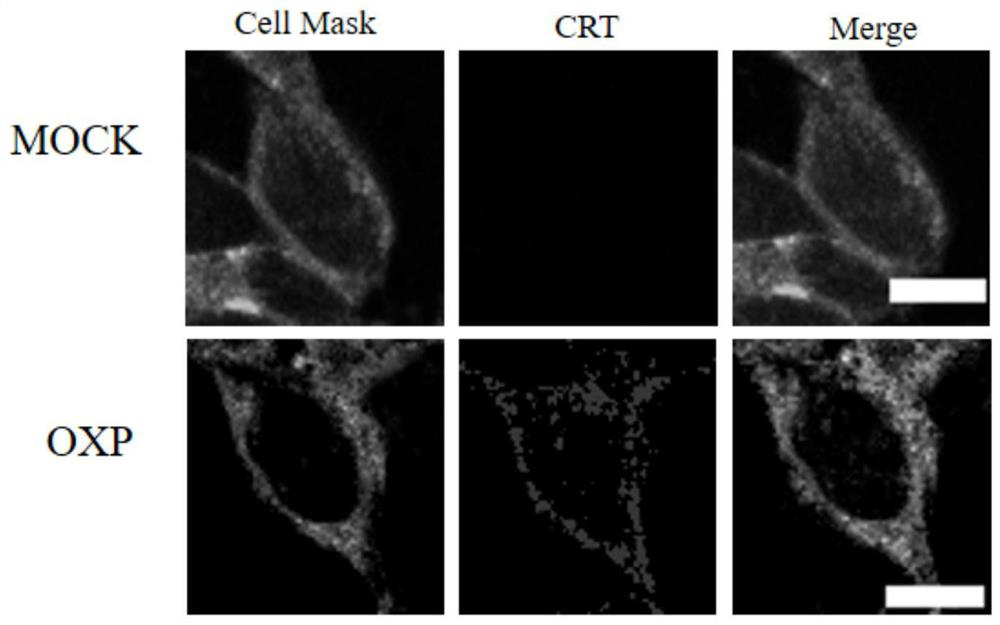 Nanometer antibody targeting calreticulin and application thereof