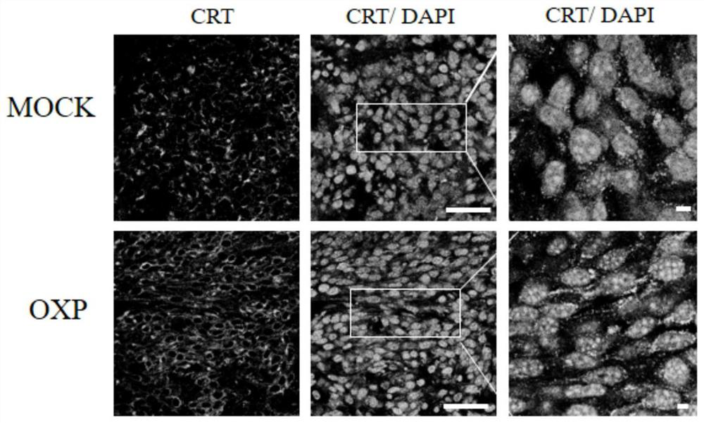 Nanometer antibody targeting calreticulin and application thereof