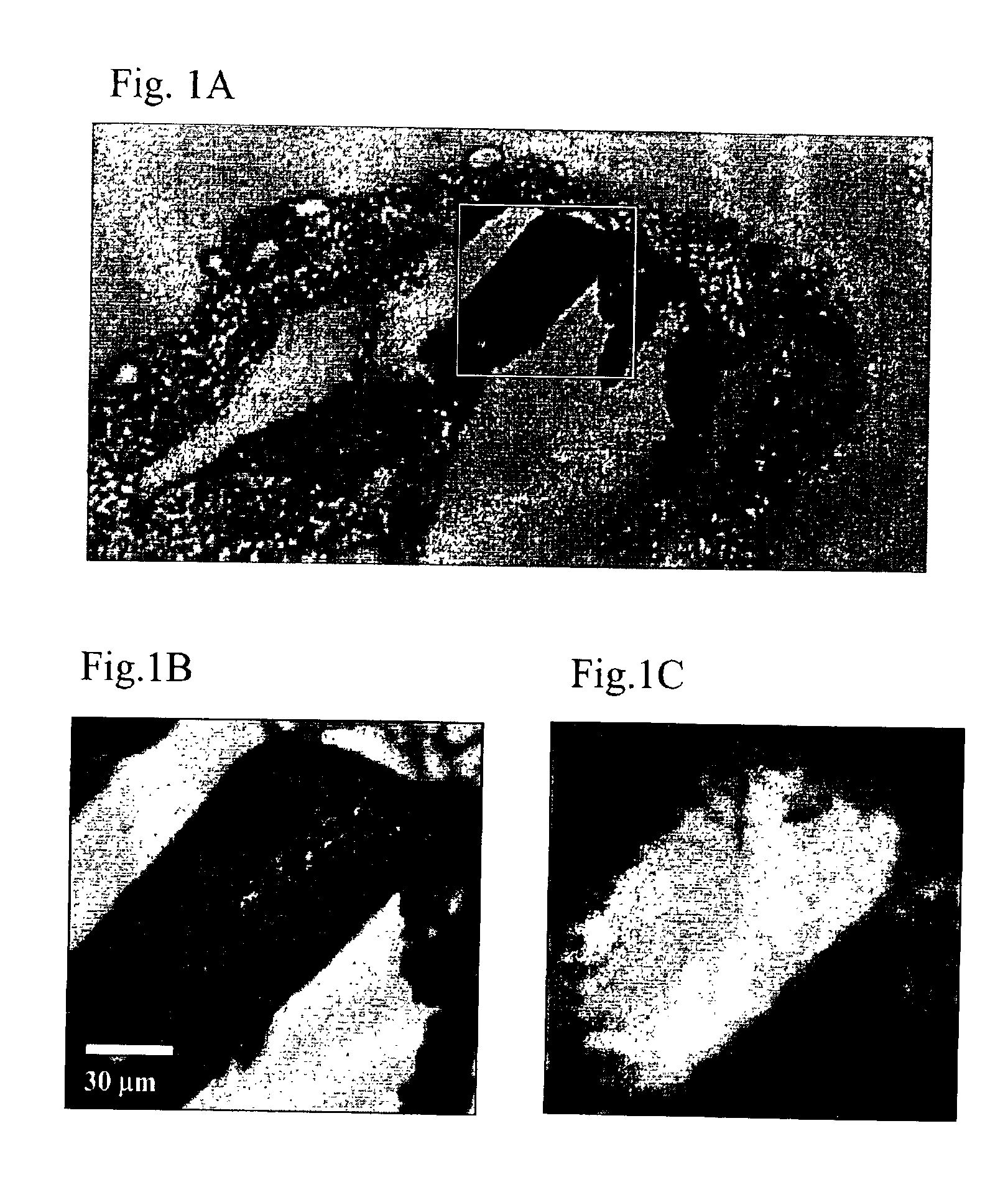 Method for Raman chemical imaging and characterization of calcification in tissue