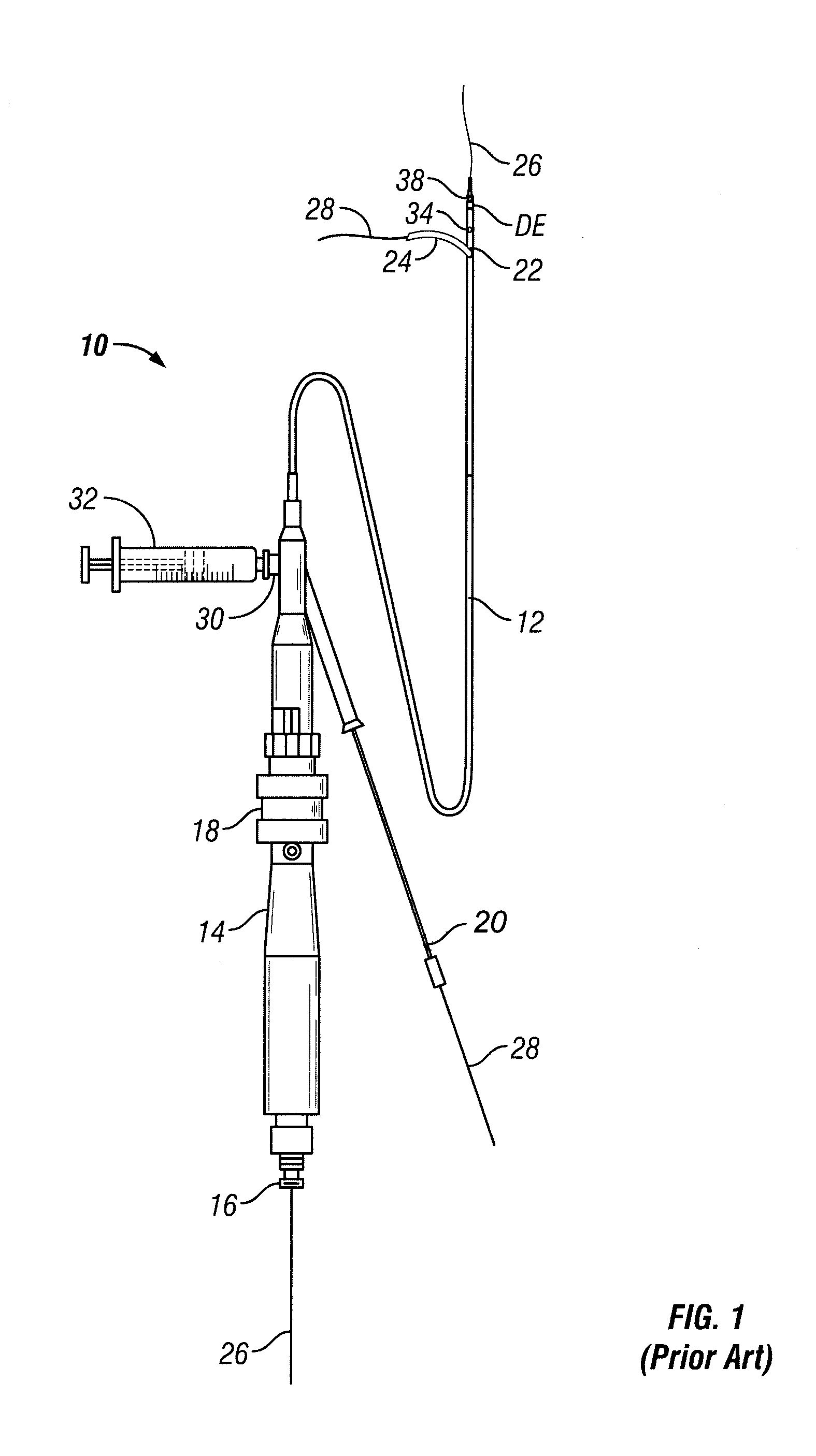 Percutaneously Introduceable Shunt Devices and Methods