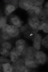 Immunoassay method and kit for assaying mycobacterium tuberculosis from biological samples