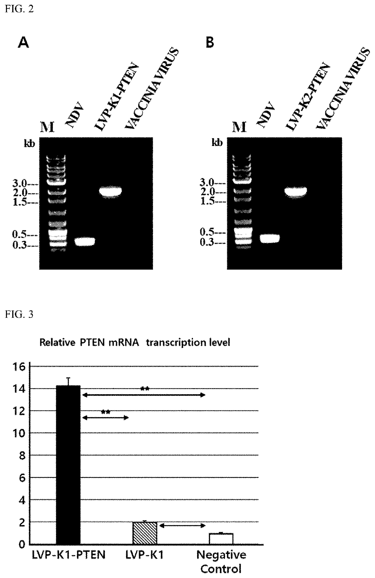 Oncolytic virus for treating brain tumors using recombinant newcastle disease virus into which newcastle disease virus vector-based pten gene is inserted and composition for treating brain tumors using same