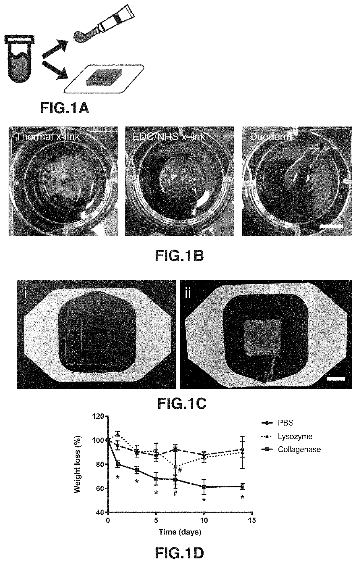 Q-peptide hydrogel promotes immune modulation and macrophage differentiation