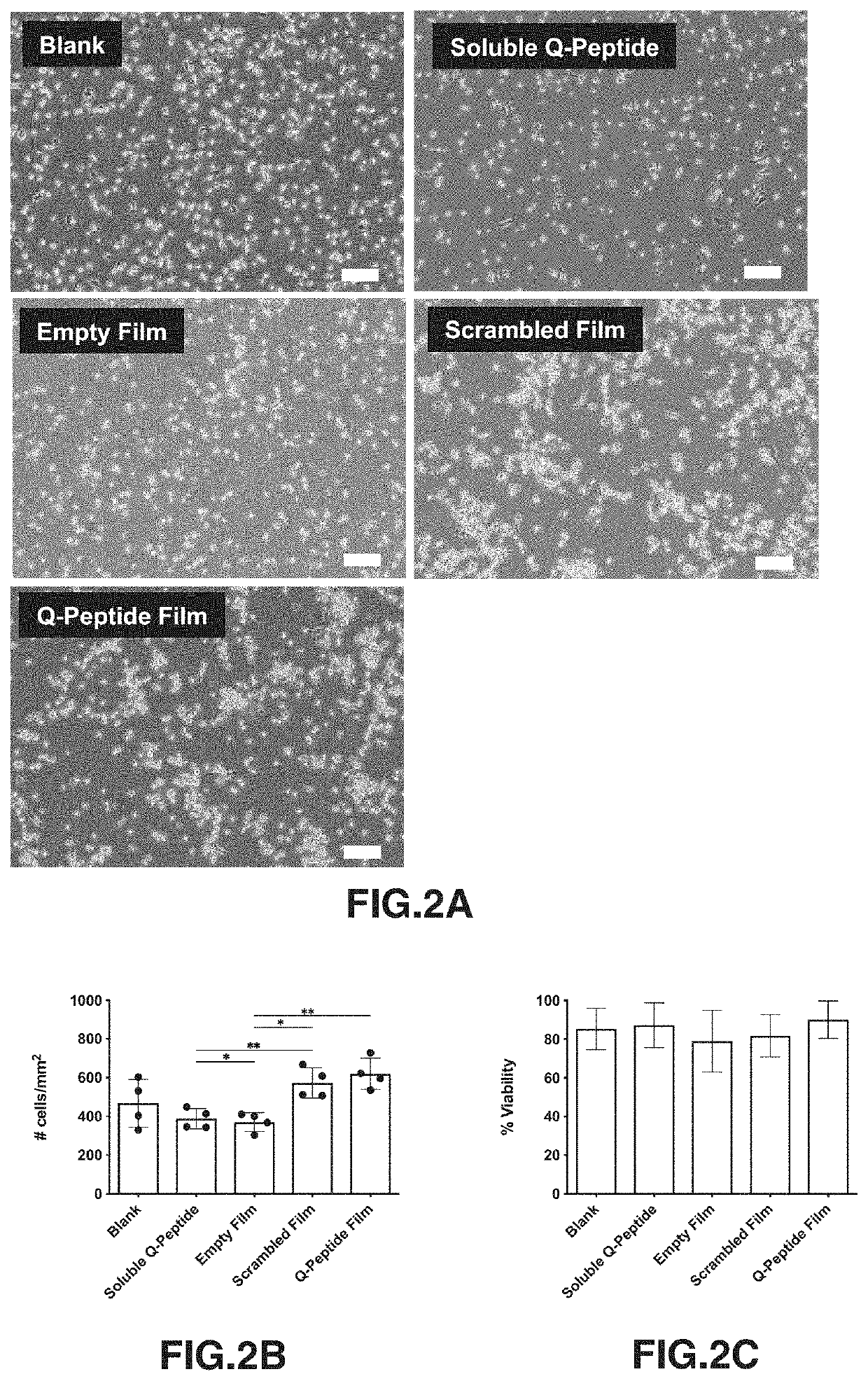 Q-peptide hydrogel promotes immune modulation and macrophage differentiation