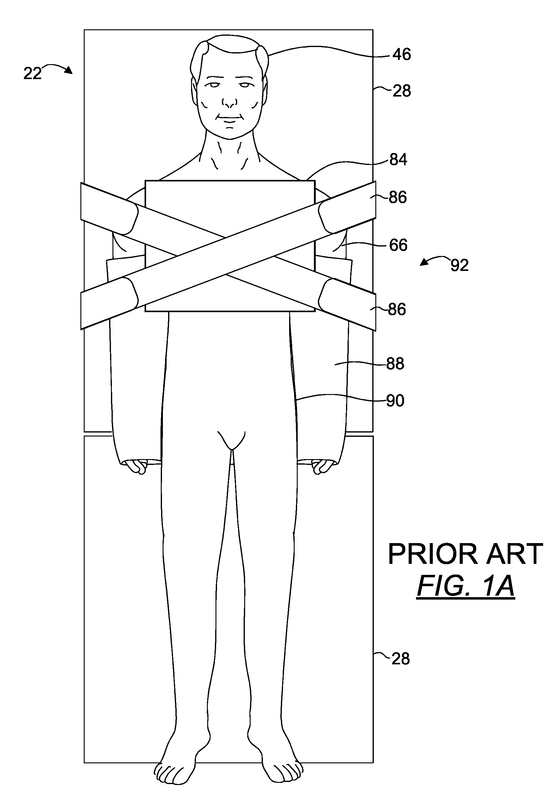 Operating table patient positioner and method