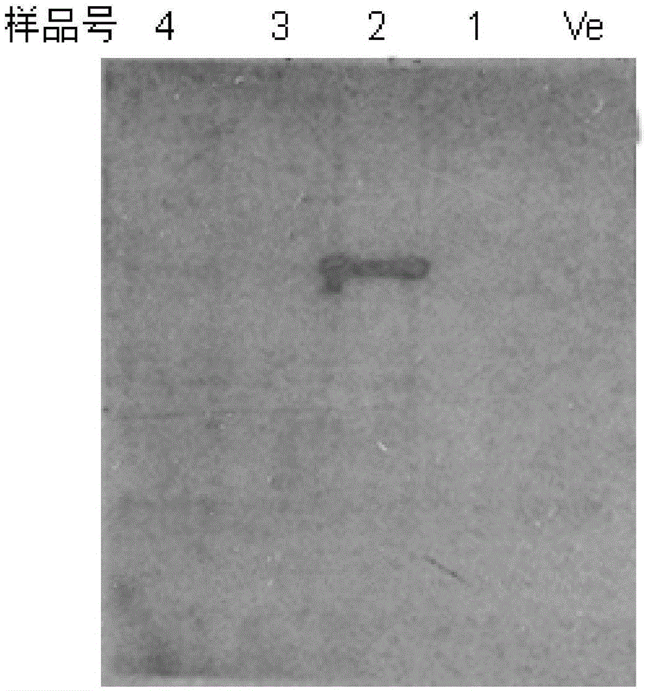 Reagent for prostatic cancer diagnosis and prognostic immunohistochemical detection