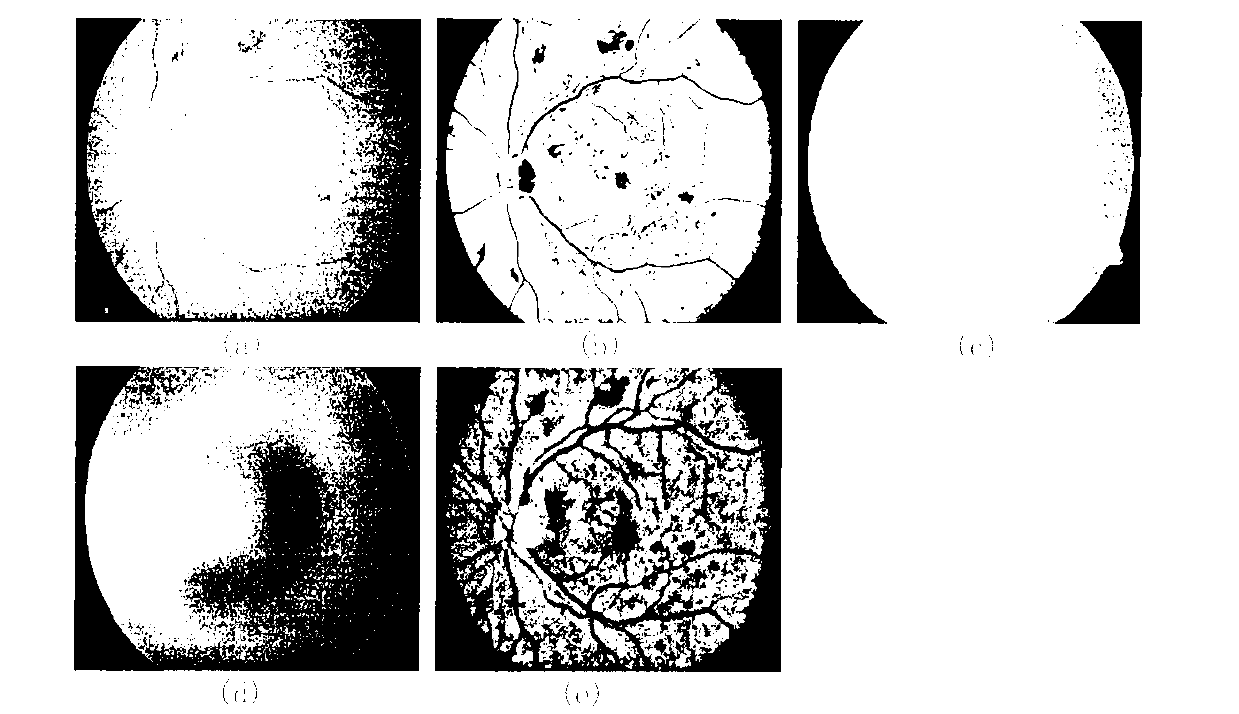 Optic disc projection location method synthesizing vascular distribution with video disc appearance characteristics