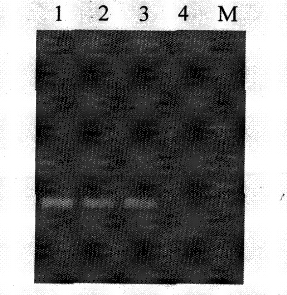 Gene for mediating drug resistance of vancomycin and application thereof
