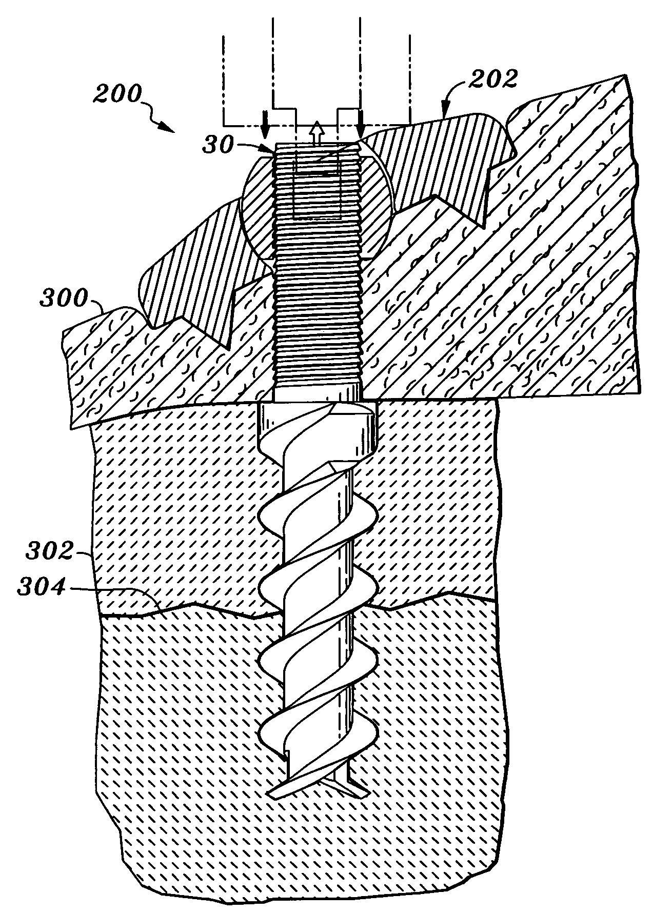 Soft tissue anchor and method of using same