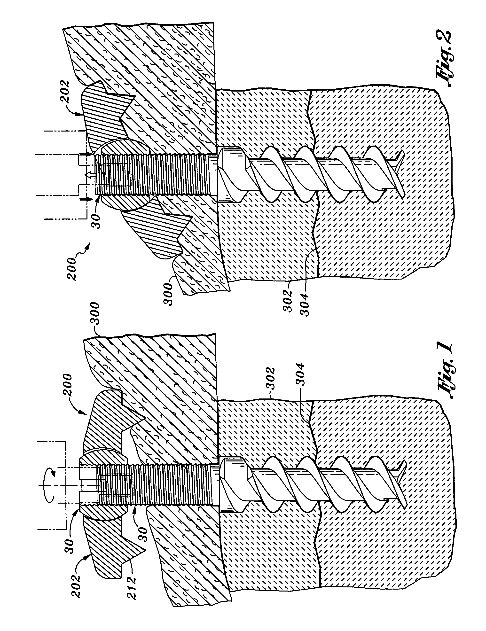 Soft tissue anchor and method of using same