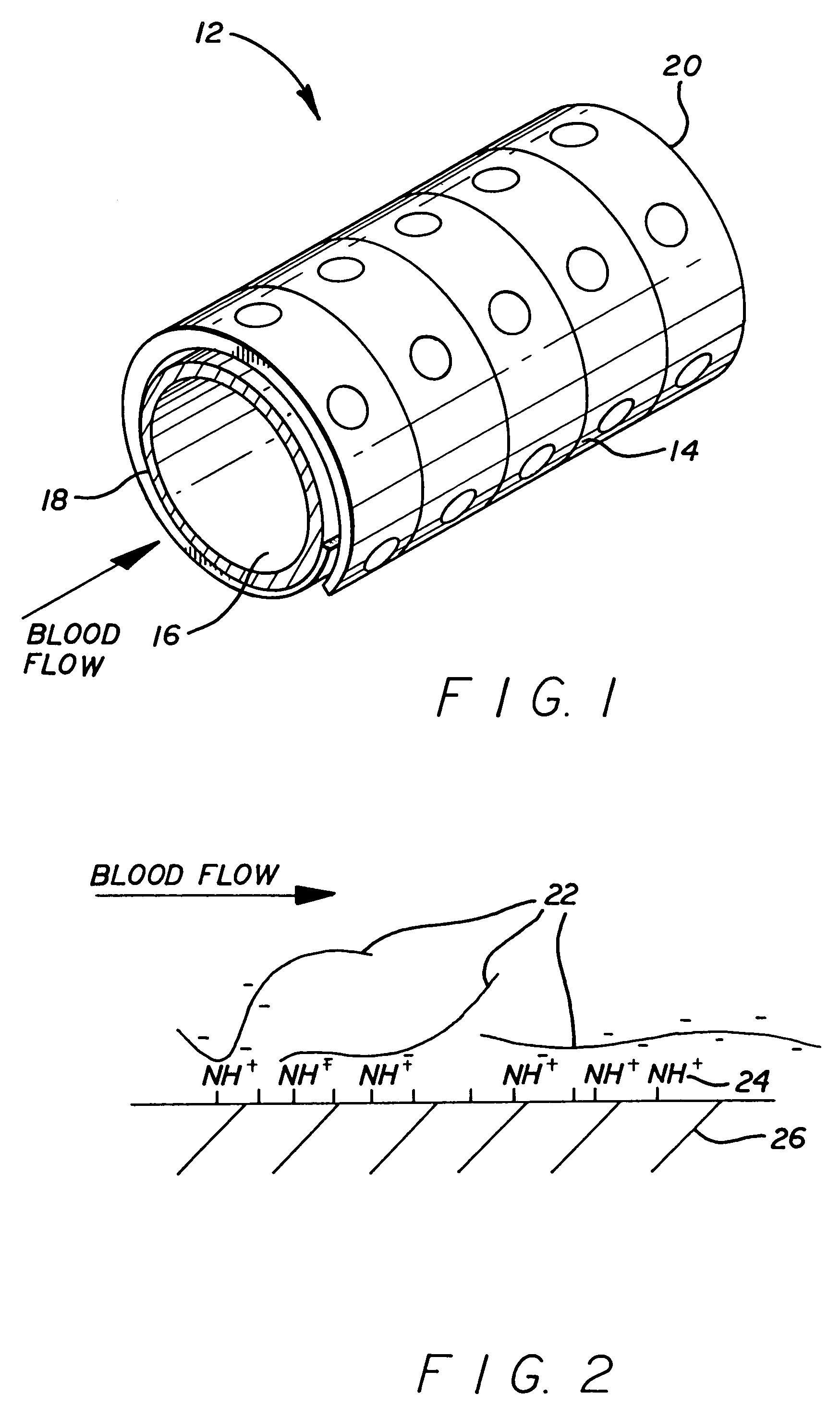 Method of reducing or eliminating thrombus formation