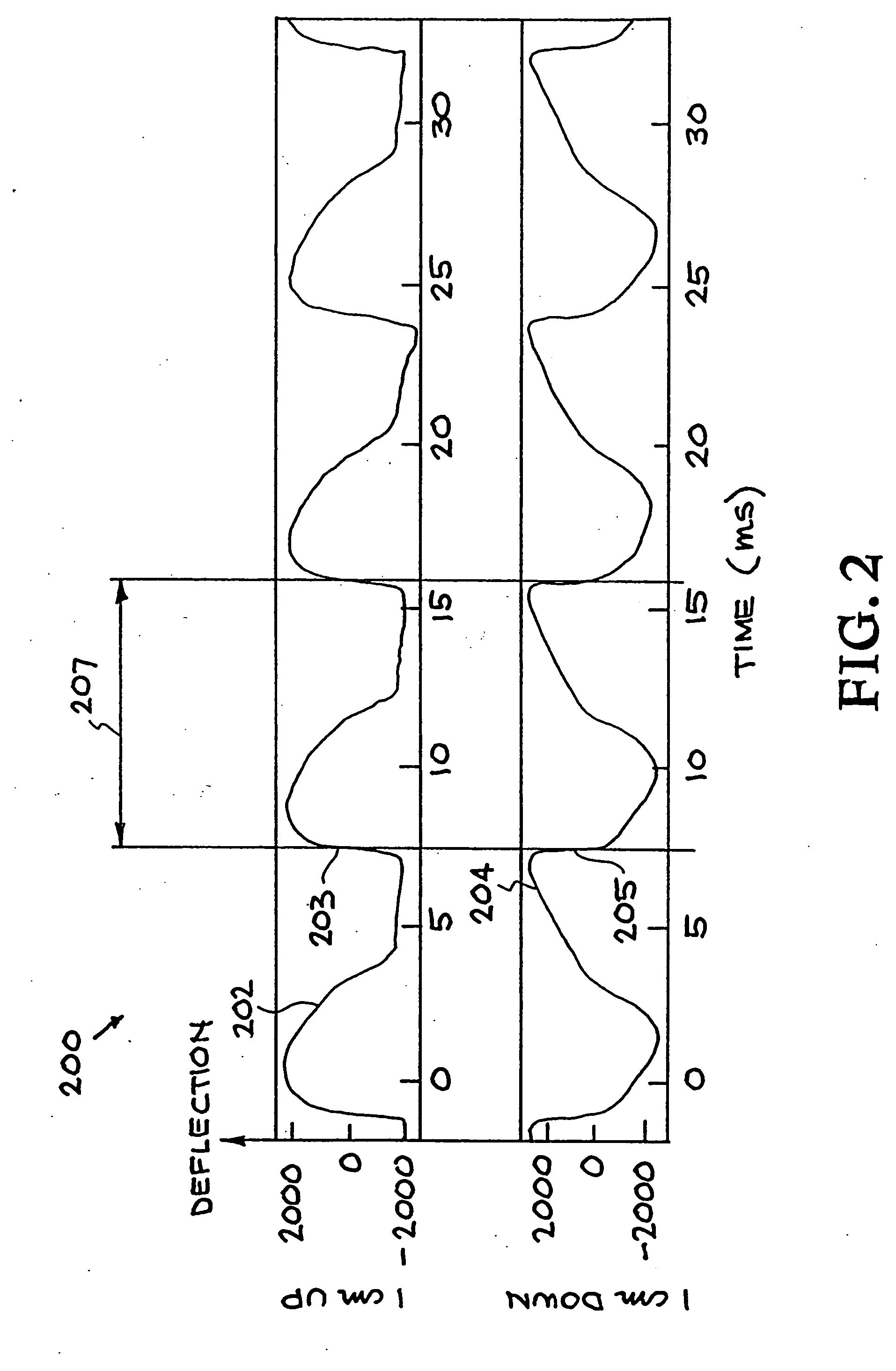 System and method for characterizing voiced excitations of speech and acoustic signals, removing acoustic noise from speech, and synthesizing speech