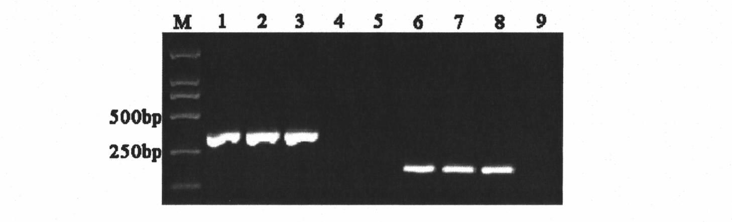 Molecule detection method of Fusarium graminearum to medium resistance level bacterial strain of carbendazim