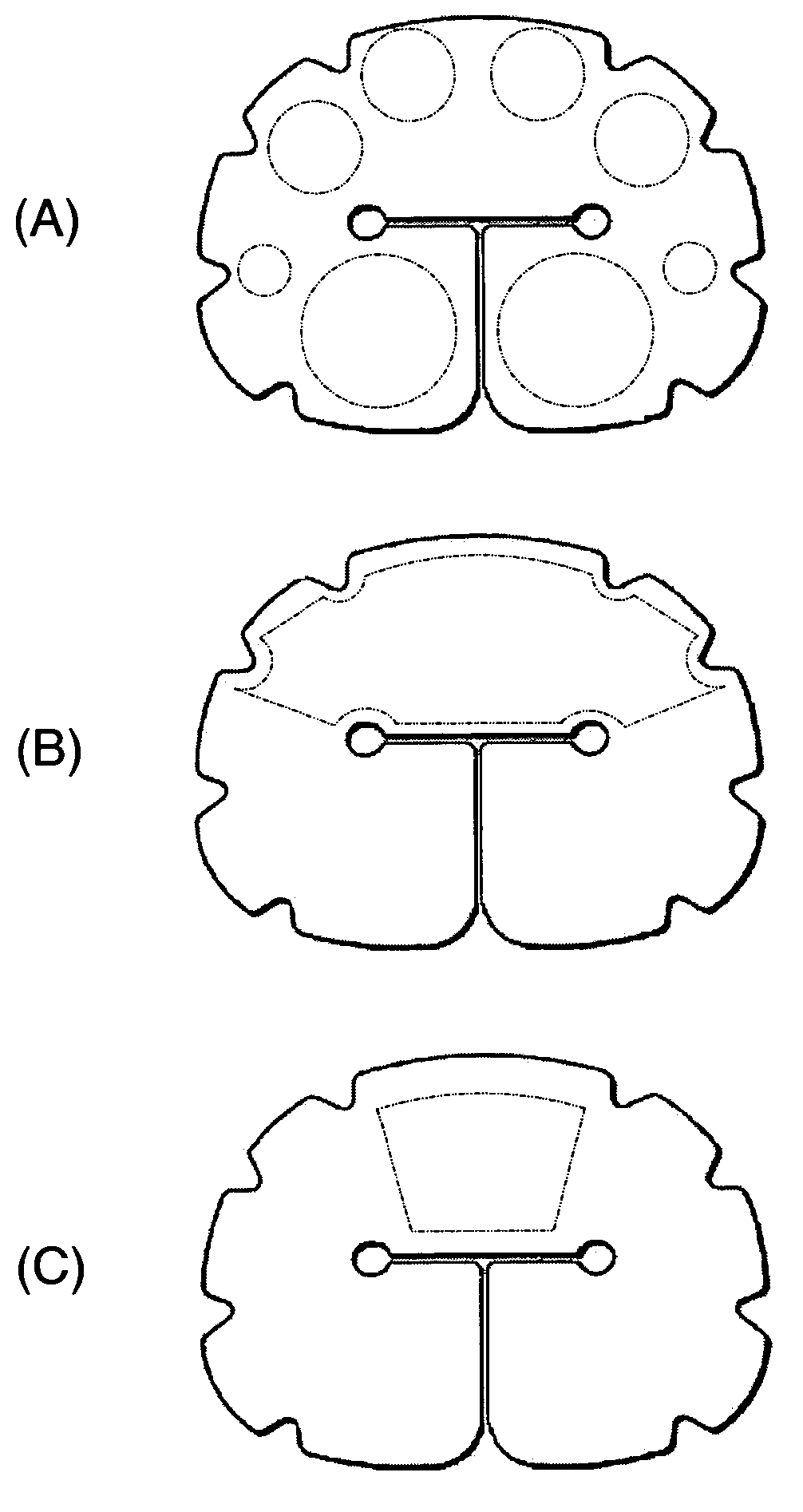 Selectively expandable composite structures for spinal arthroplasty