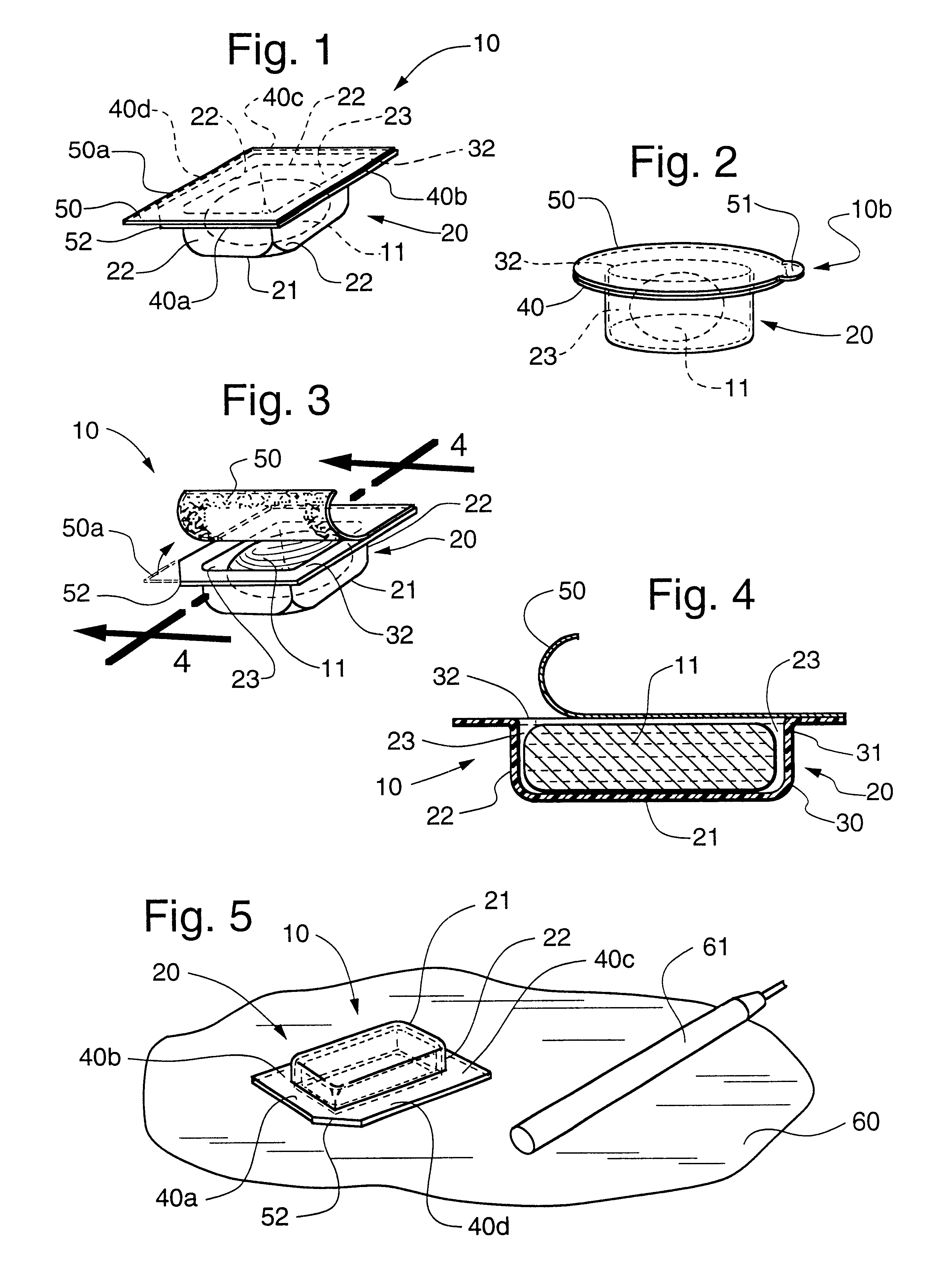 Dental composite restorative material and method of restoring a tooth
