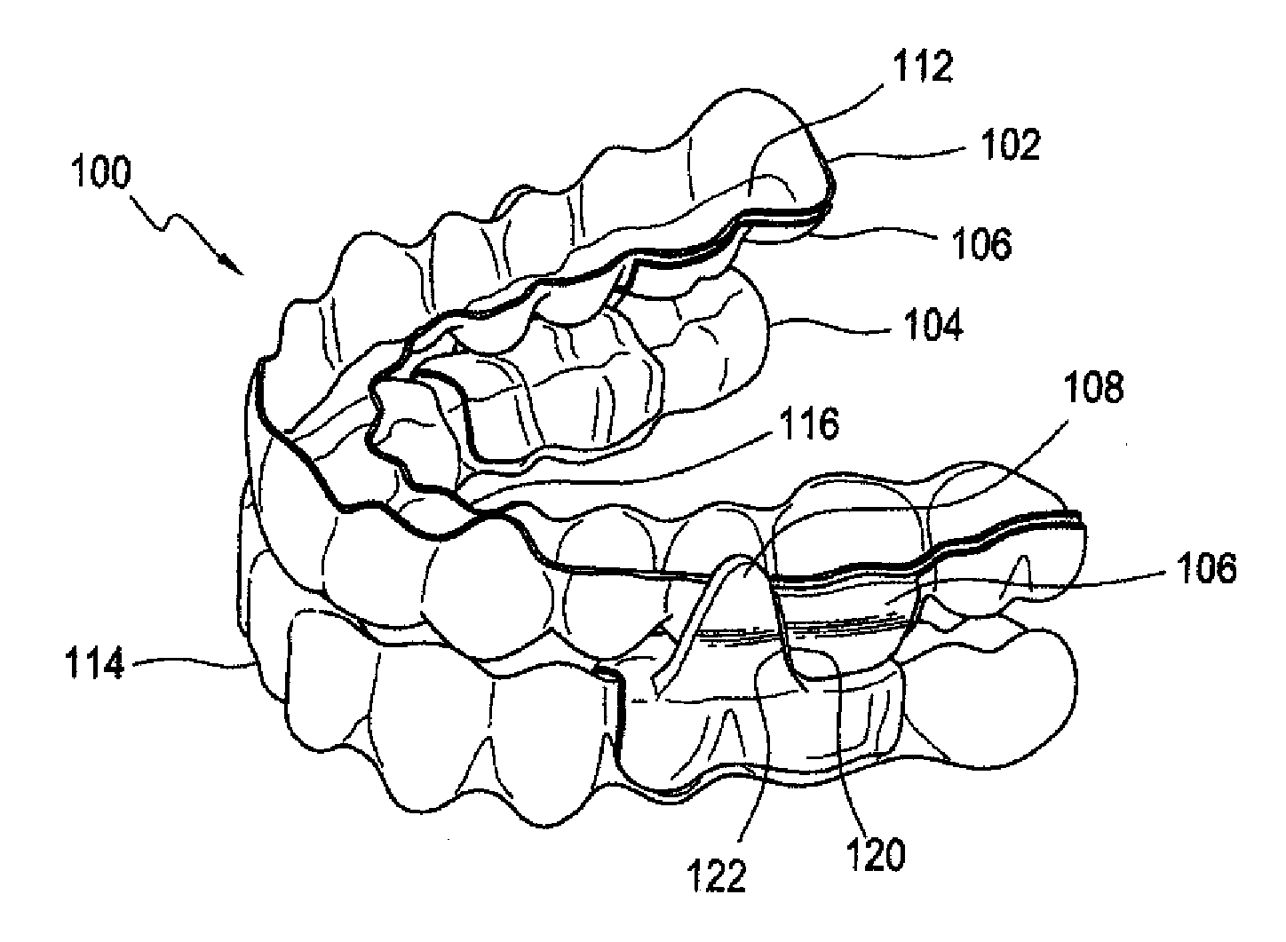 System and Method for Treating Obstructive Sleep Apnea and Correcting Malocclusion Simultaneously