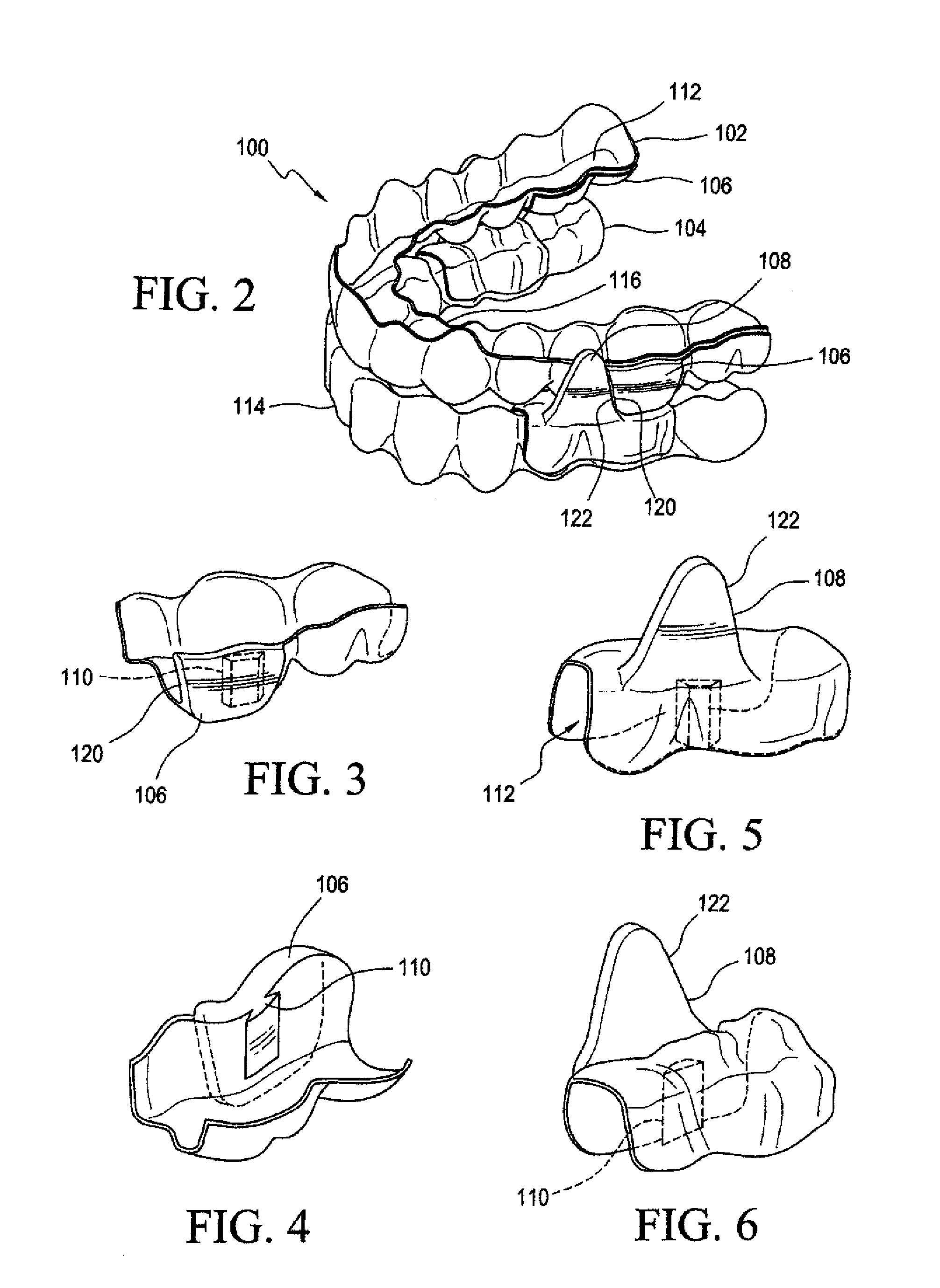 System and Method for Treating Obstructive Sleep Apnea and Correcting Malocclusion Simultaneously