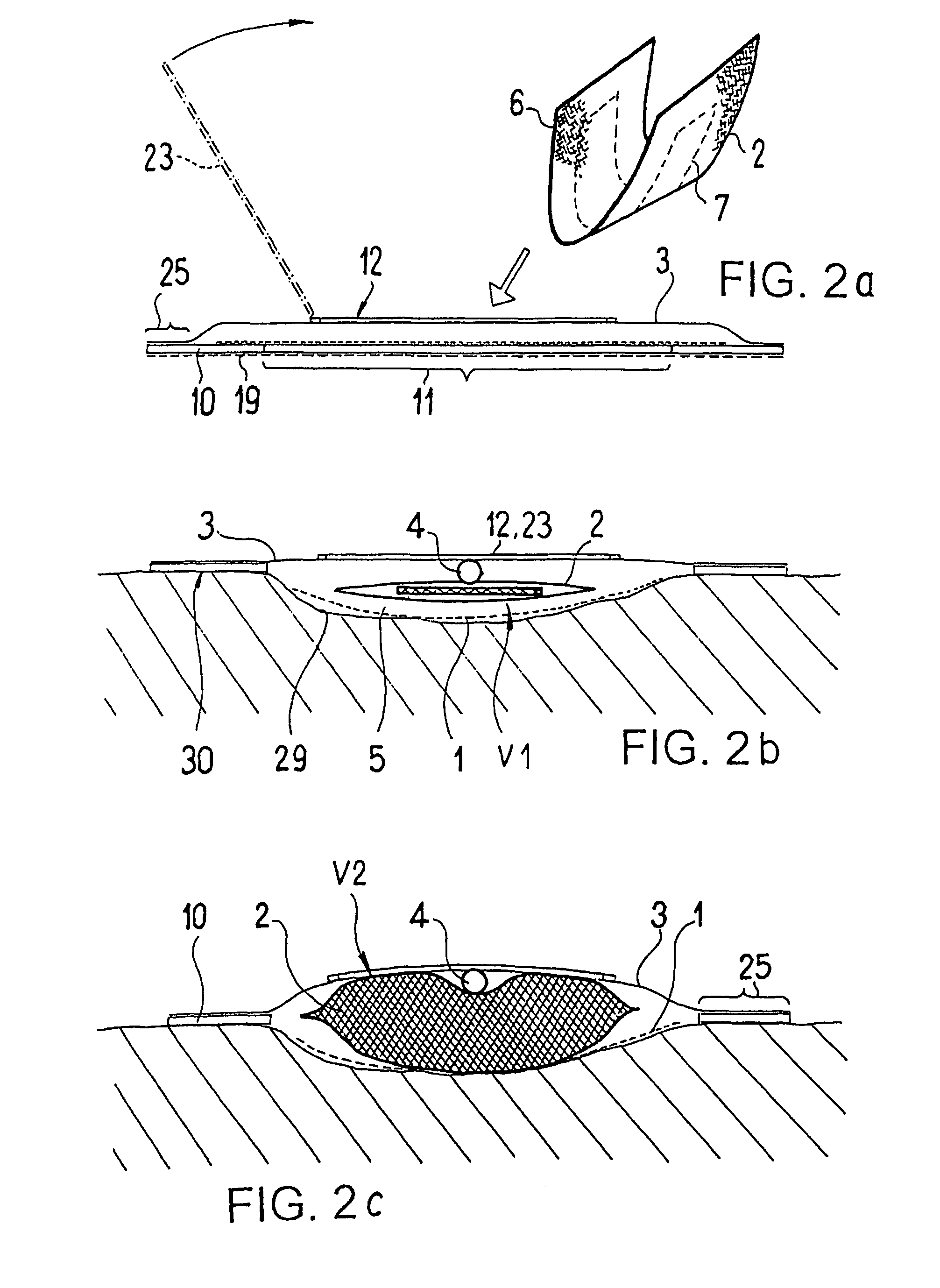 Drainage device for treating wounds using a reduced pressure