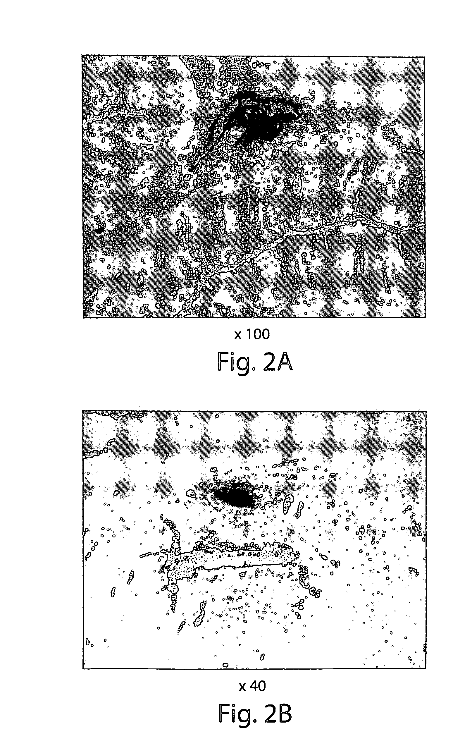 Muscle derived cells for the treatment of cardiac pathologies and methods of making and using the same