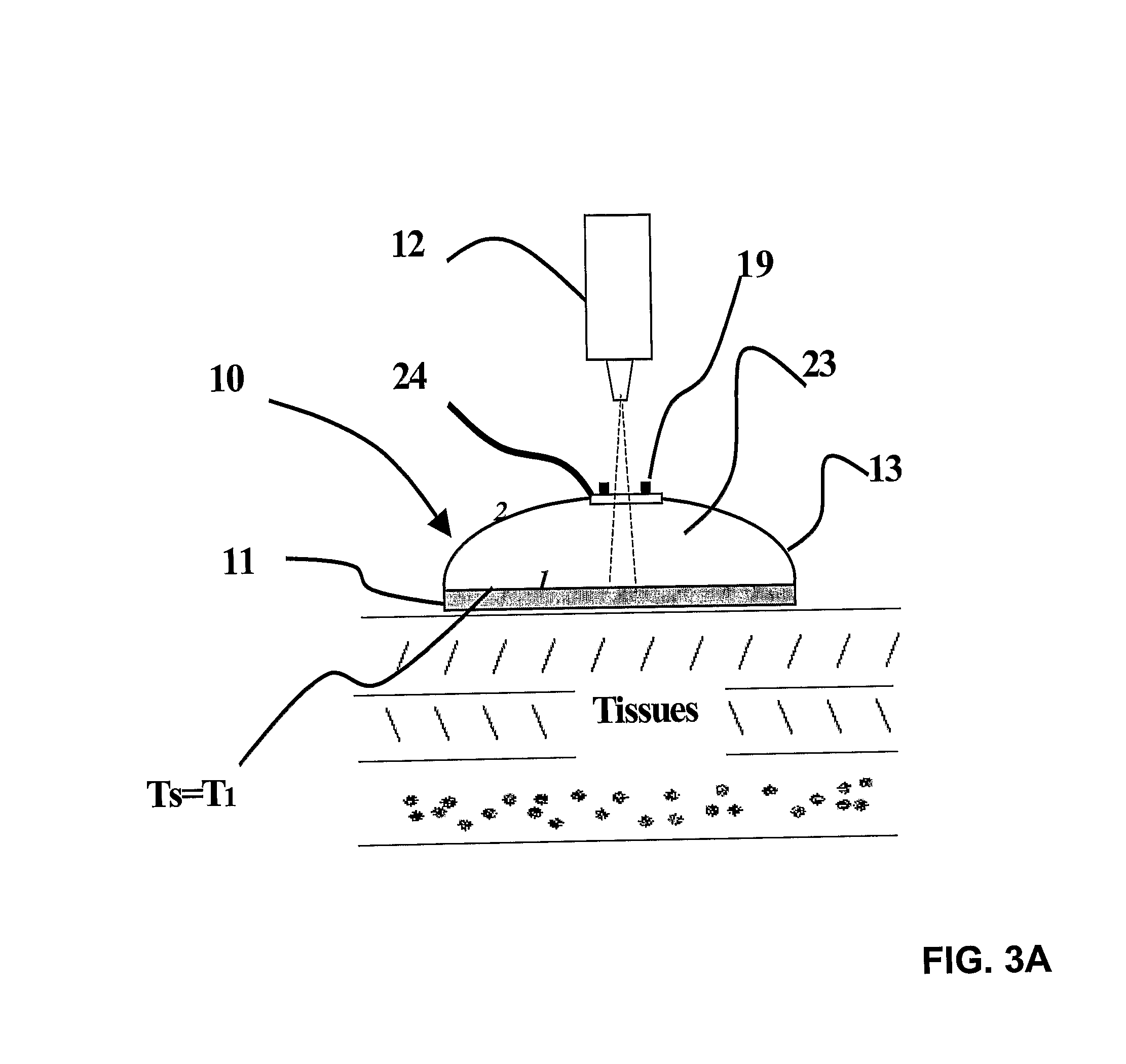 Temperature Measurement Device