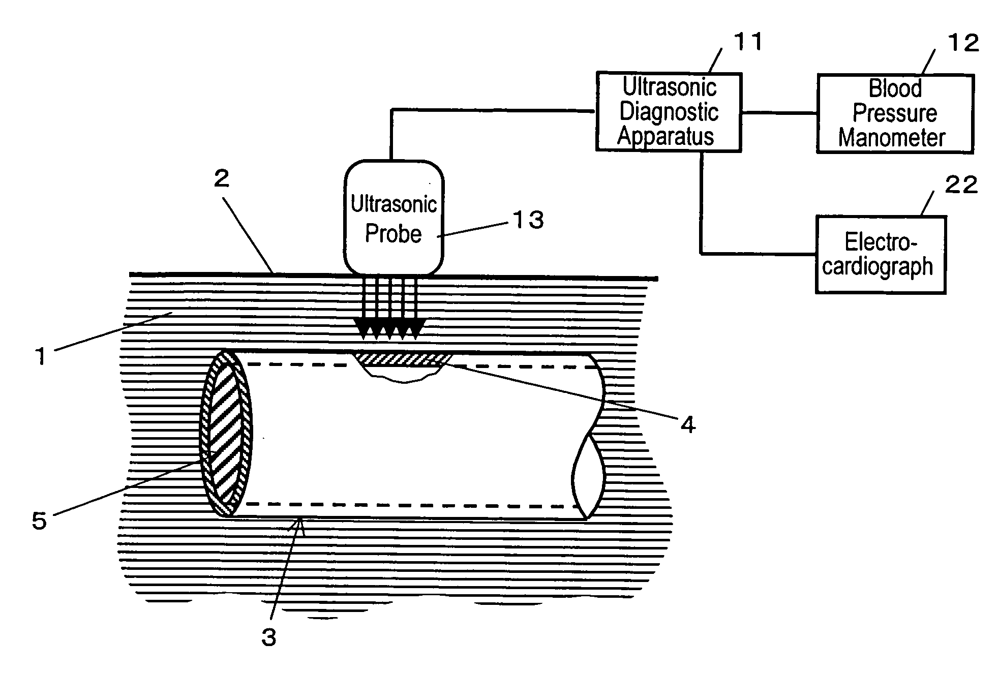 Ultrasonic diagnostic apparatus and method for controlling the same