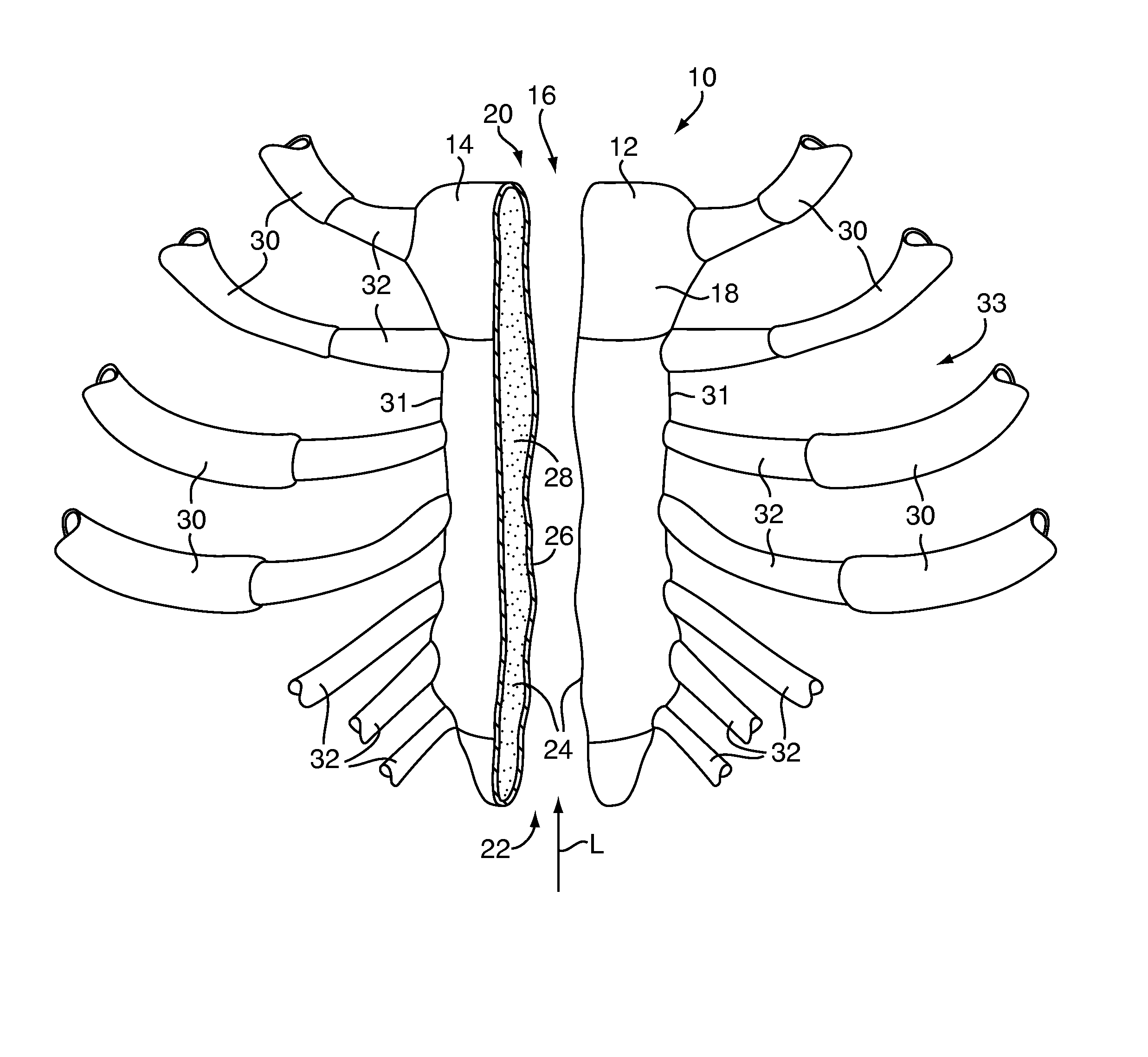Methods and devices for sternal closure