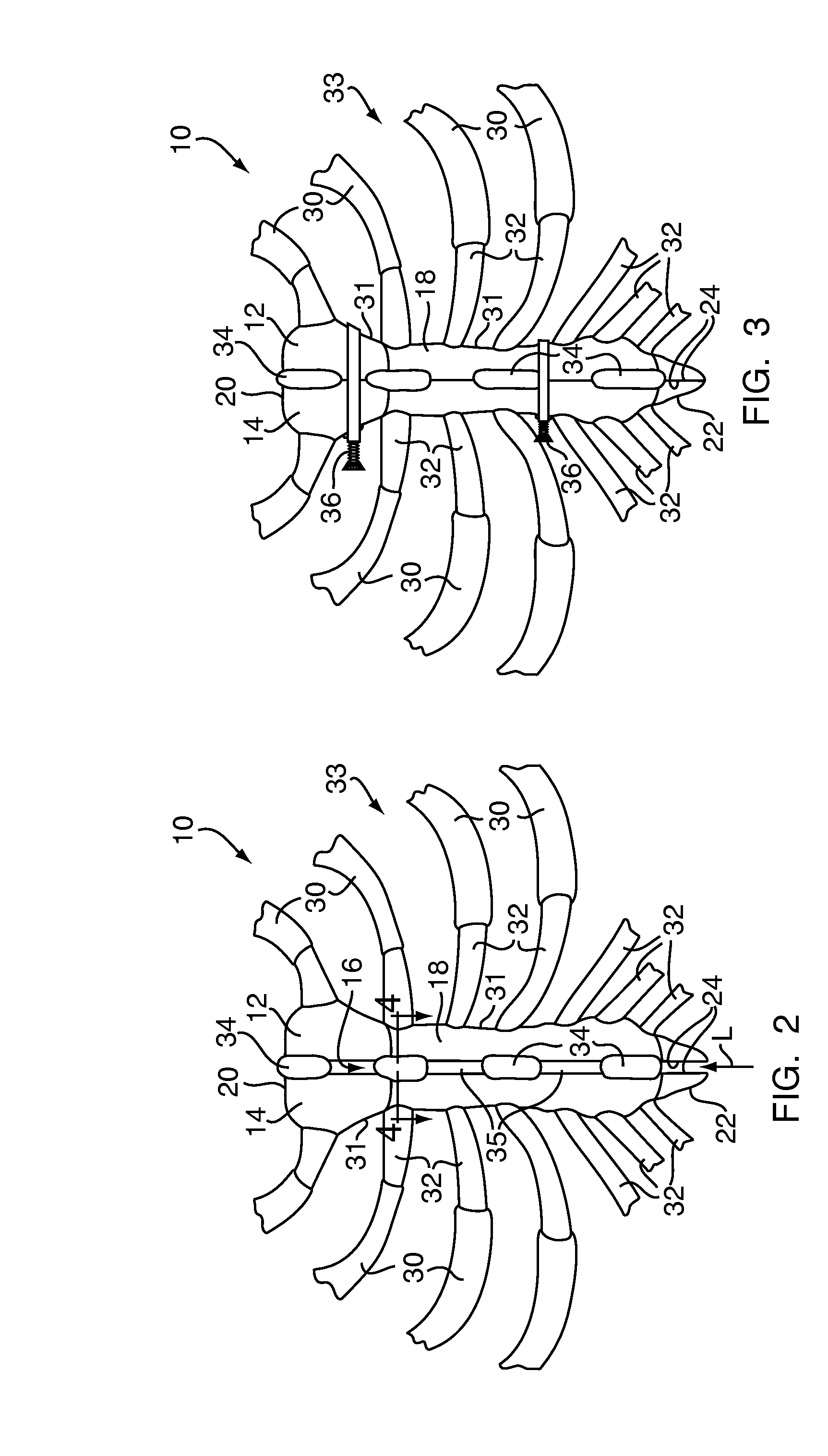 Methods and devices for sternal closure