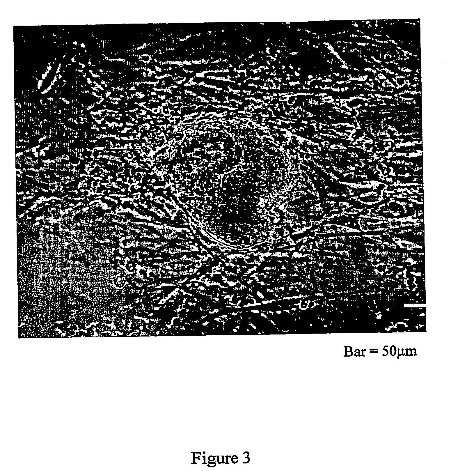 Method for isolating, culturing and differentiating intestinal stem cells for therapeutic use