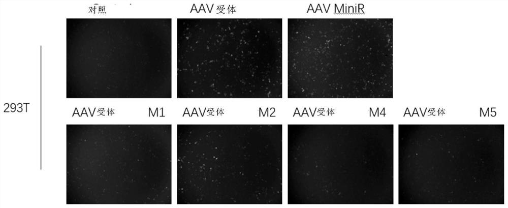 A method for improving the efficiency of gene therapy by overexpressing adeno-associated virus receptor
