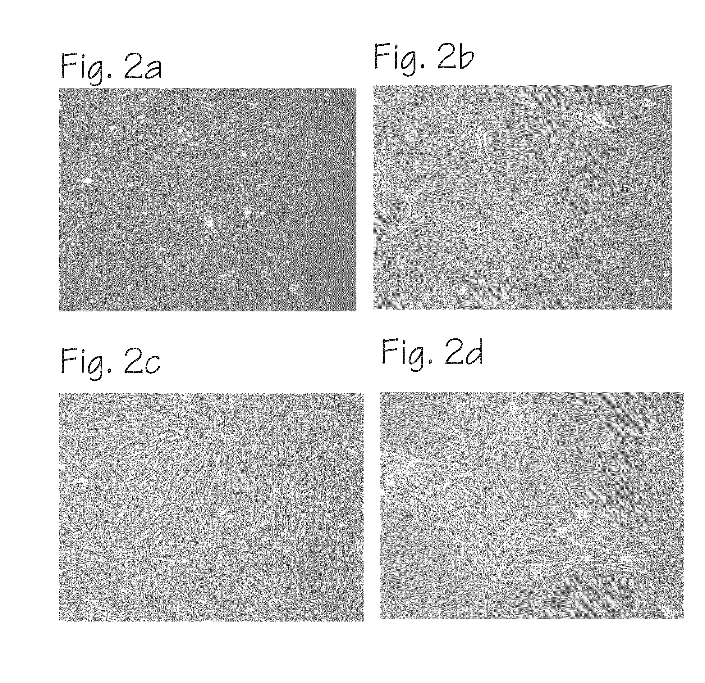 Method of Preparing Autologous Cells and Method of Use for Therapy