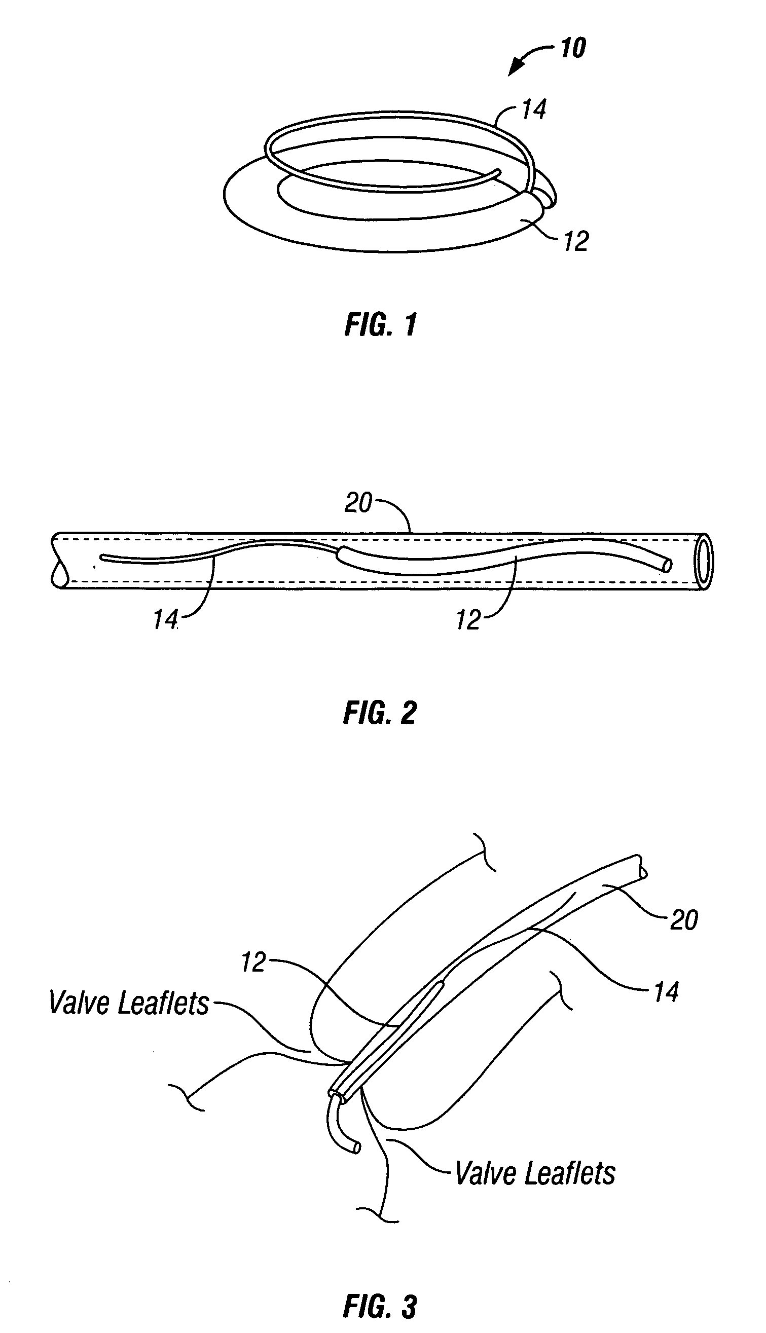 Method and apparatus for tissue connection