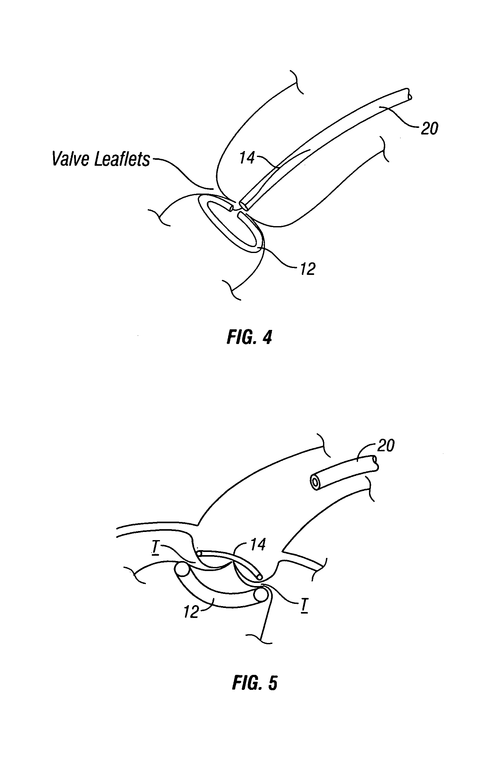 Method and apparatus for tissue connection