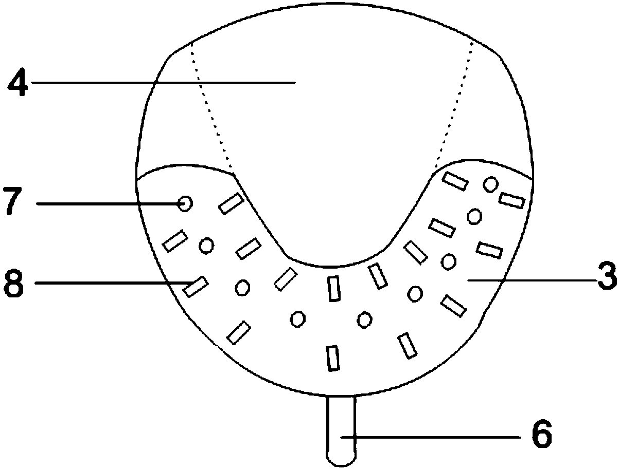 Dental stent for making radiotherapy individualized mouth holding device