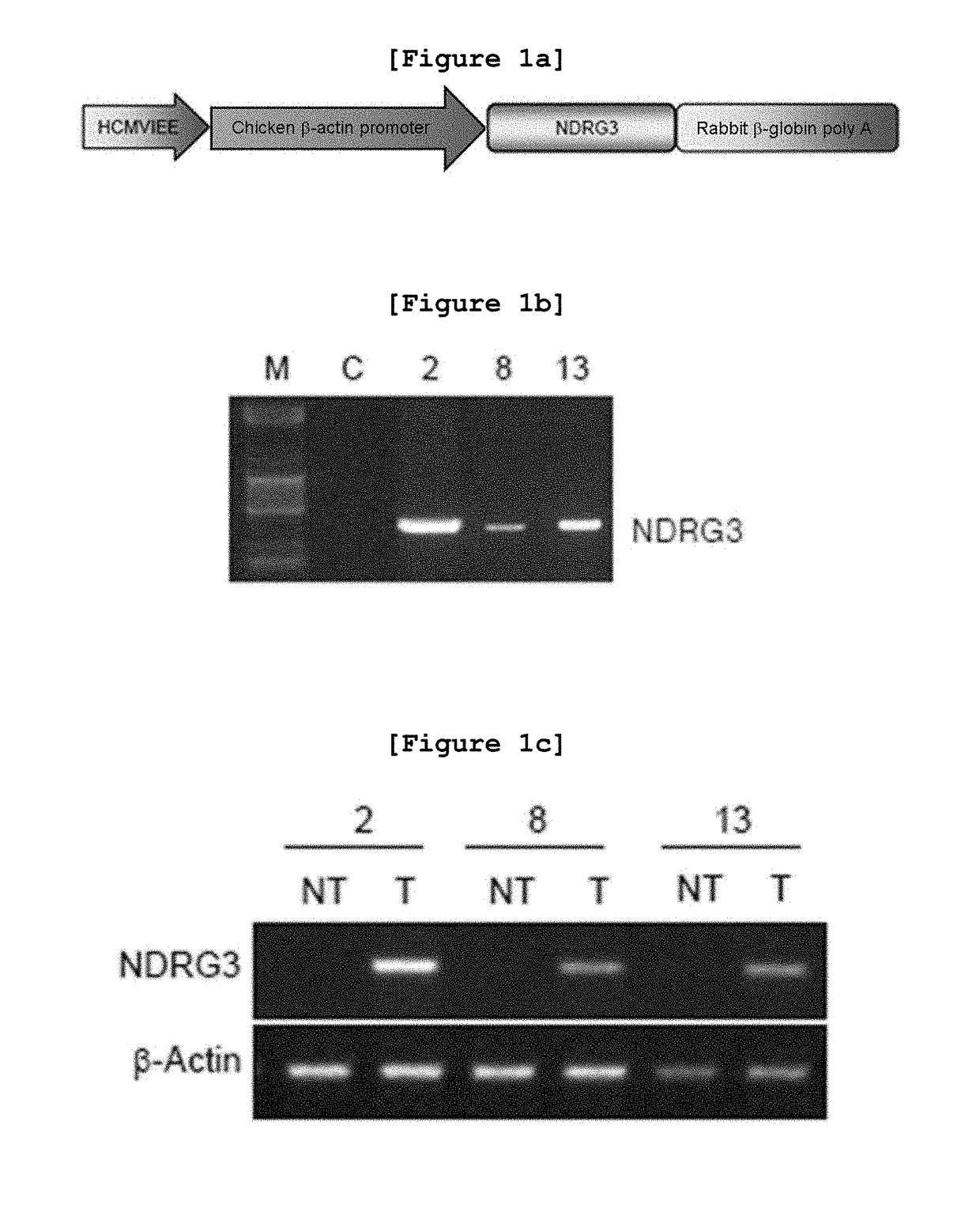 Pharmaceutical composition for cancer prevention and treatment, containing ndrg3 expression or activity inhibitor as active ingredient, or ndrg3 protein-specific antibody and use thereof