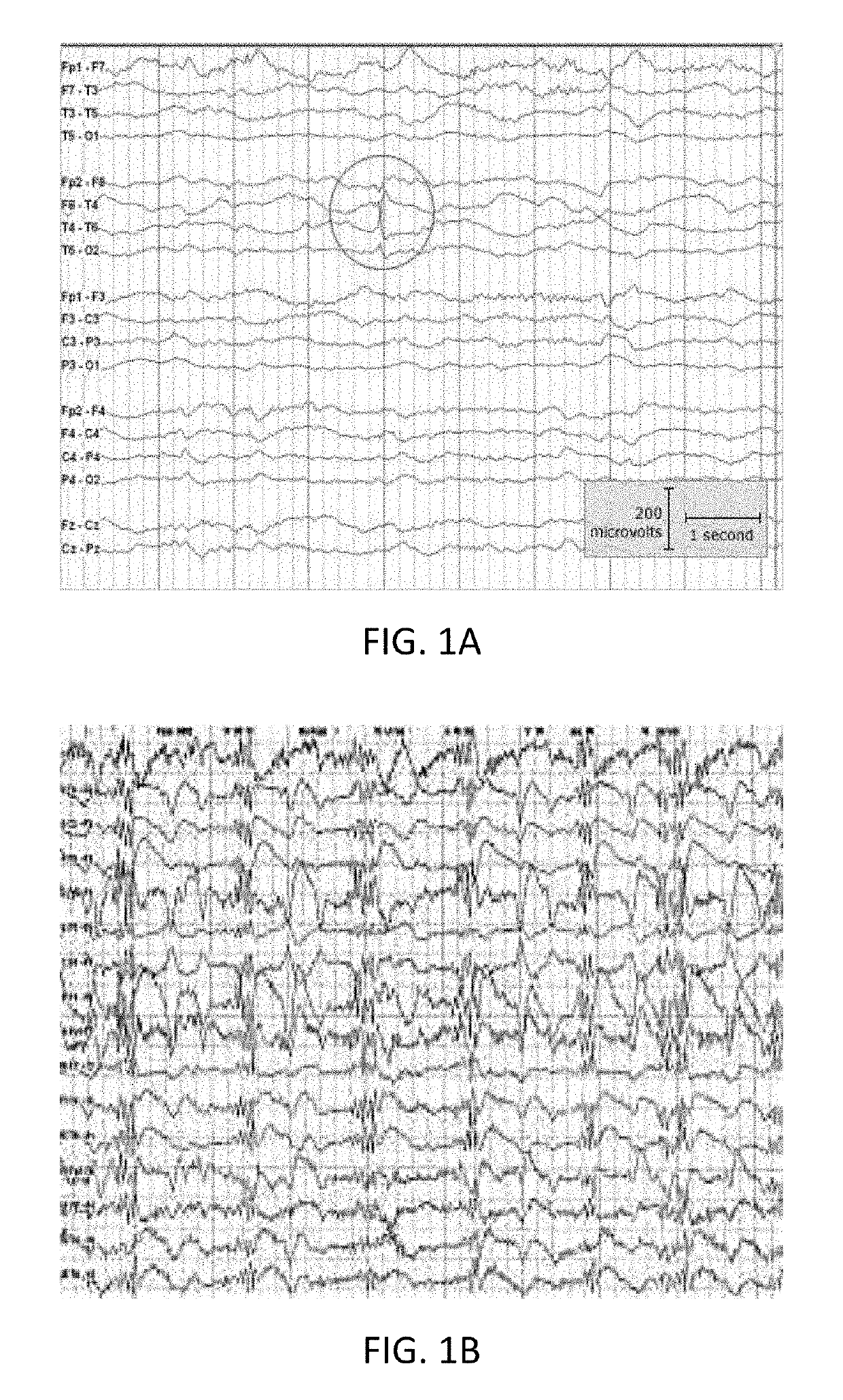 System and Method for Automatic Interpretation of EEG Signals Using a Deep Learning Statistical Model