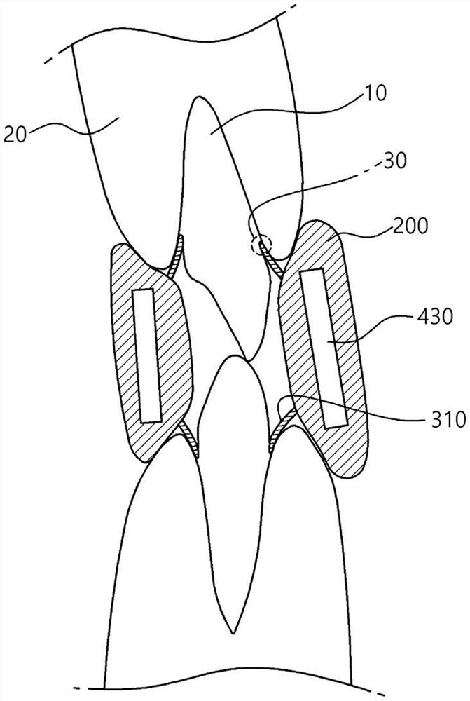 Periodontal pocket cleaning device for cleaning periodontal pockets by being inserted into periodontal pocket formed at boundary between teeth and gums, and method for manufacturing periodontal pocket cleaning device