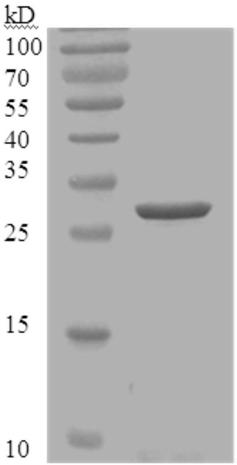 Staphylococcus aureus staphyloccucal enterotoxins B resistant monoclonal antibody YG11-2 and application thereof