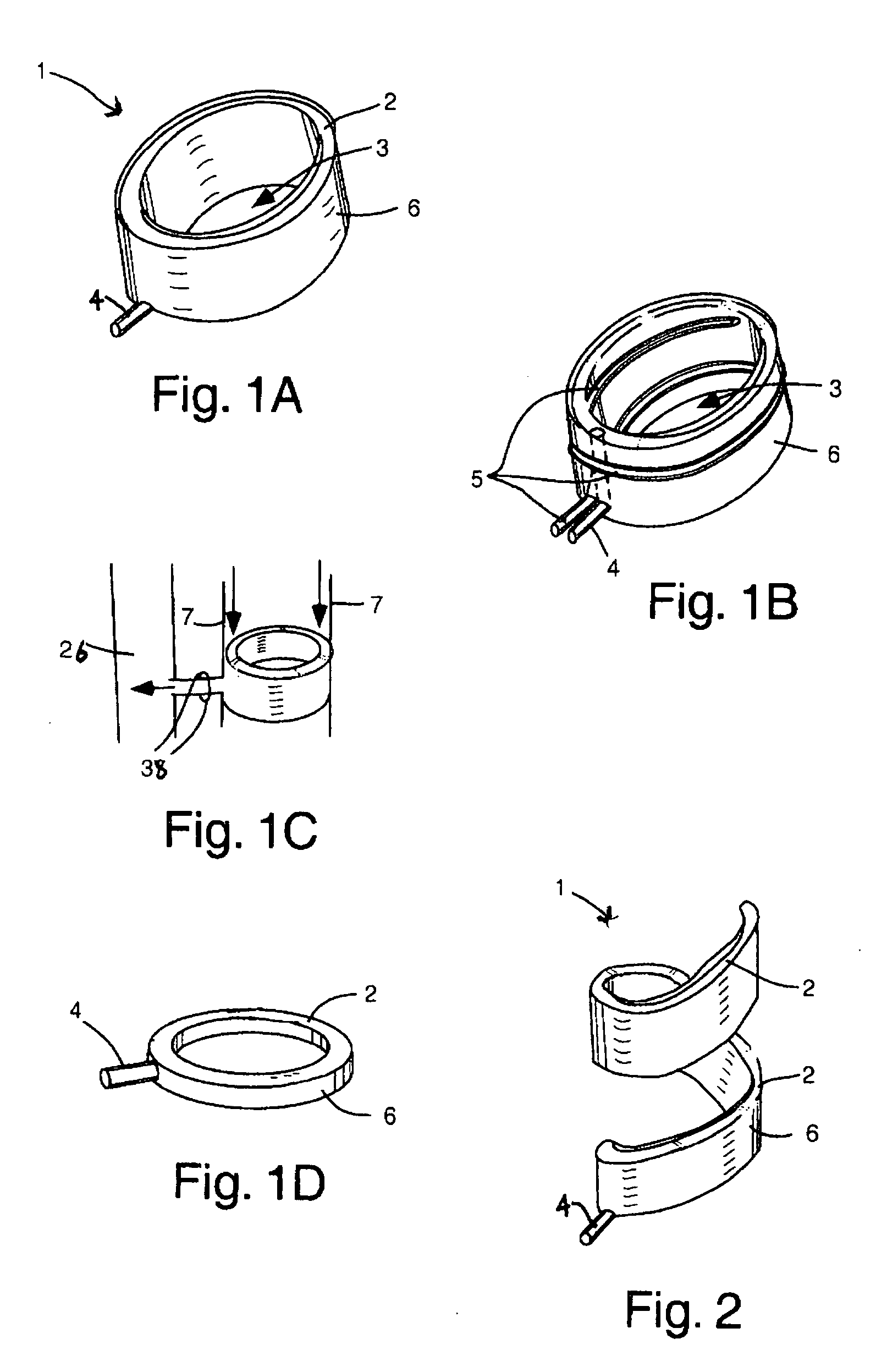 Airway implant devices and methods of use