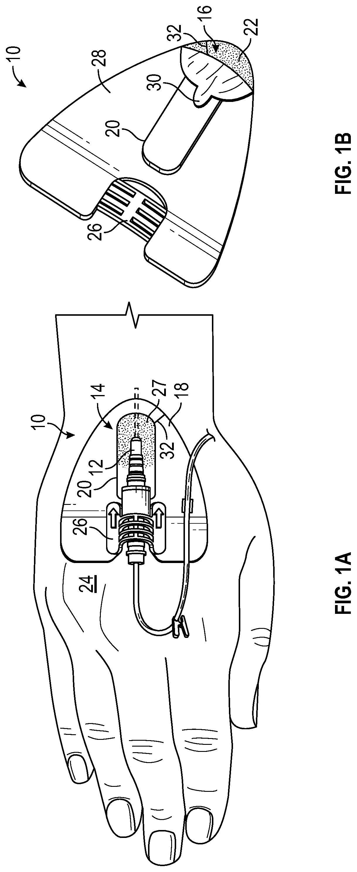 Catheter securement device with window