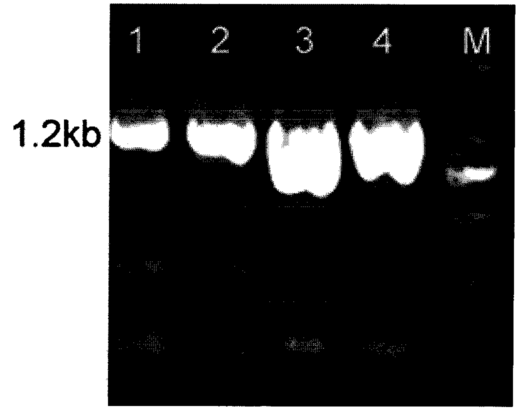 Influenza virus H1N1 subtype neuraminidase as well as gene, inhibitor screening model and application thereof