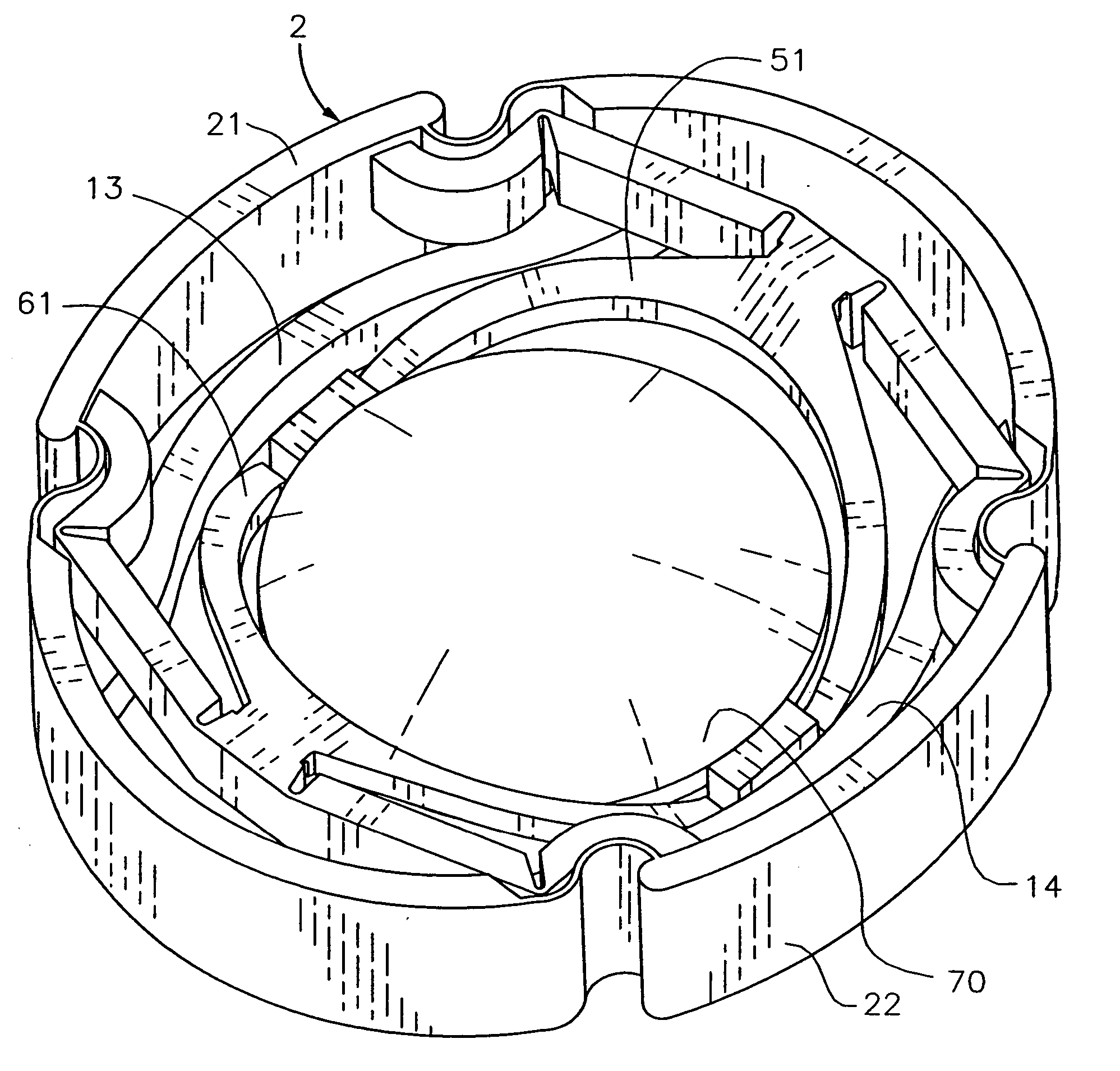 Accommodative intraocular lens system