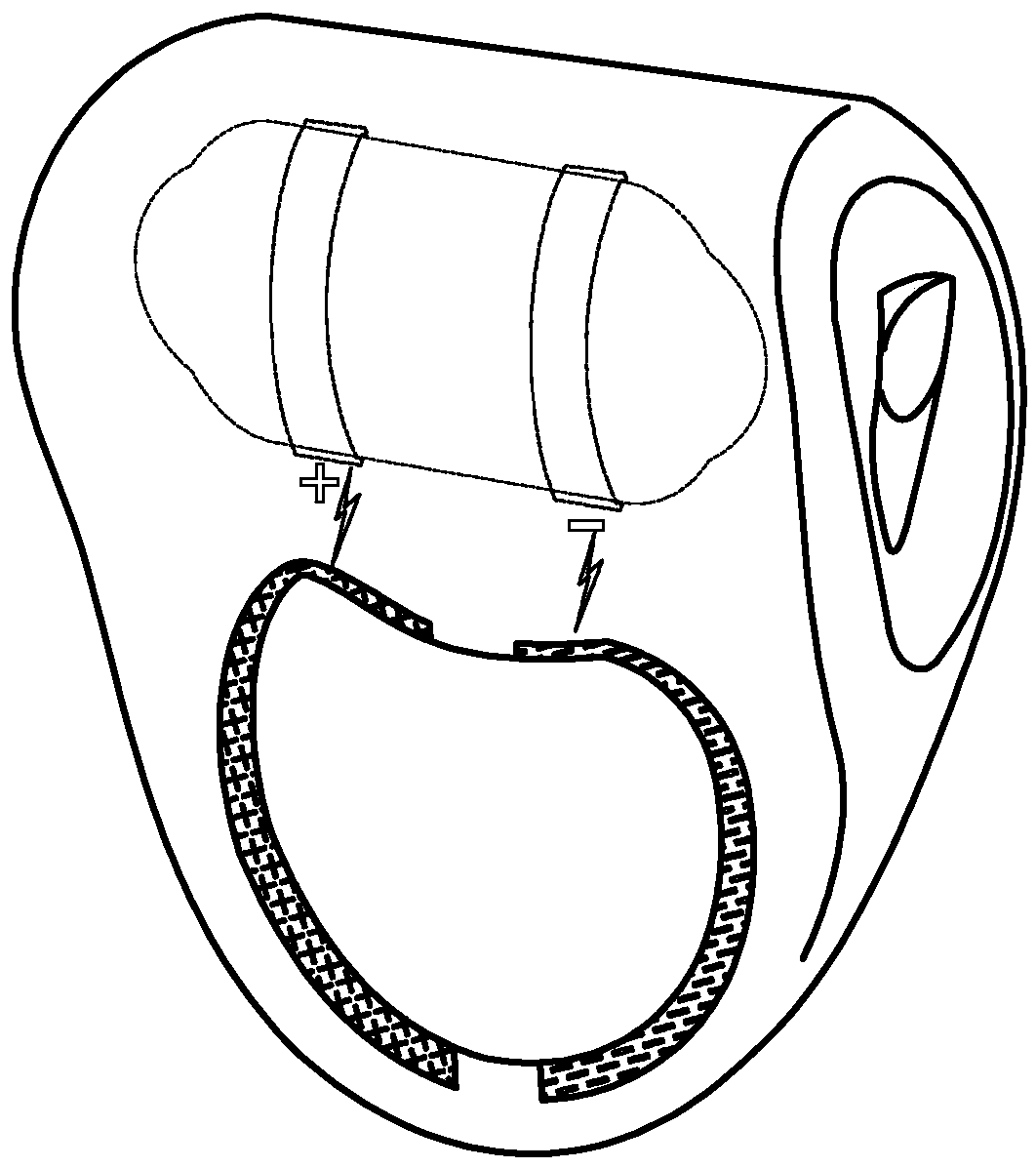 Electroconductive condom and contraception device