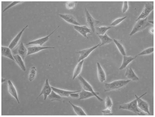 Primary human osteosarcoma cell strain NEO217-luc from spine and construction method and application of cell strain