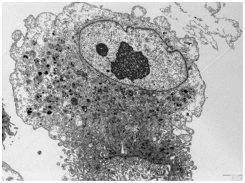 Primary human osteosarcoma cell strain NEO217-luc from spine and construction method and application of cell strain