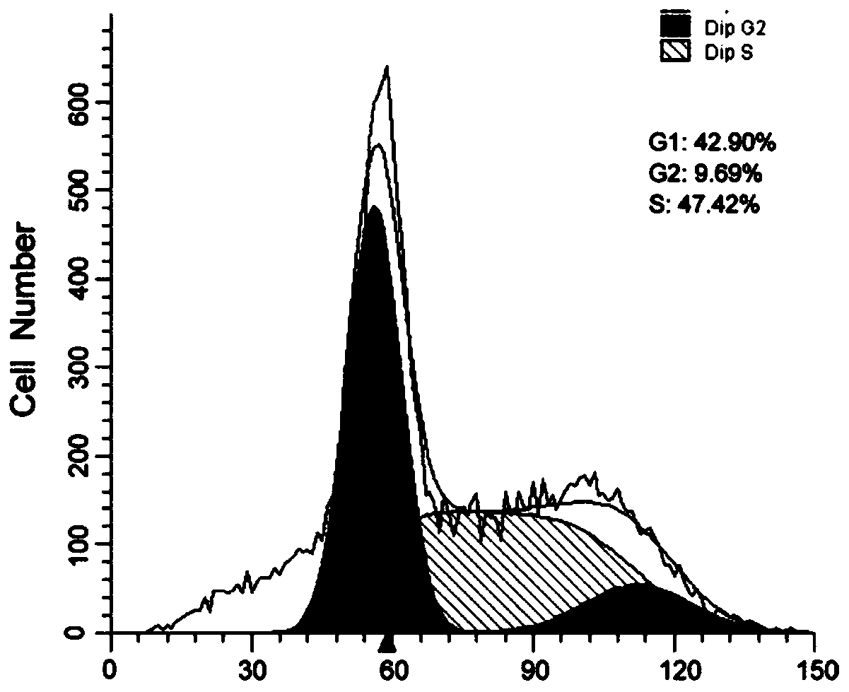 Primary human osteosarcoma cell strain NEO217-luc from spine and construction method and application of cell strain