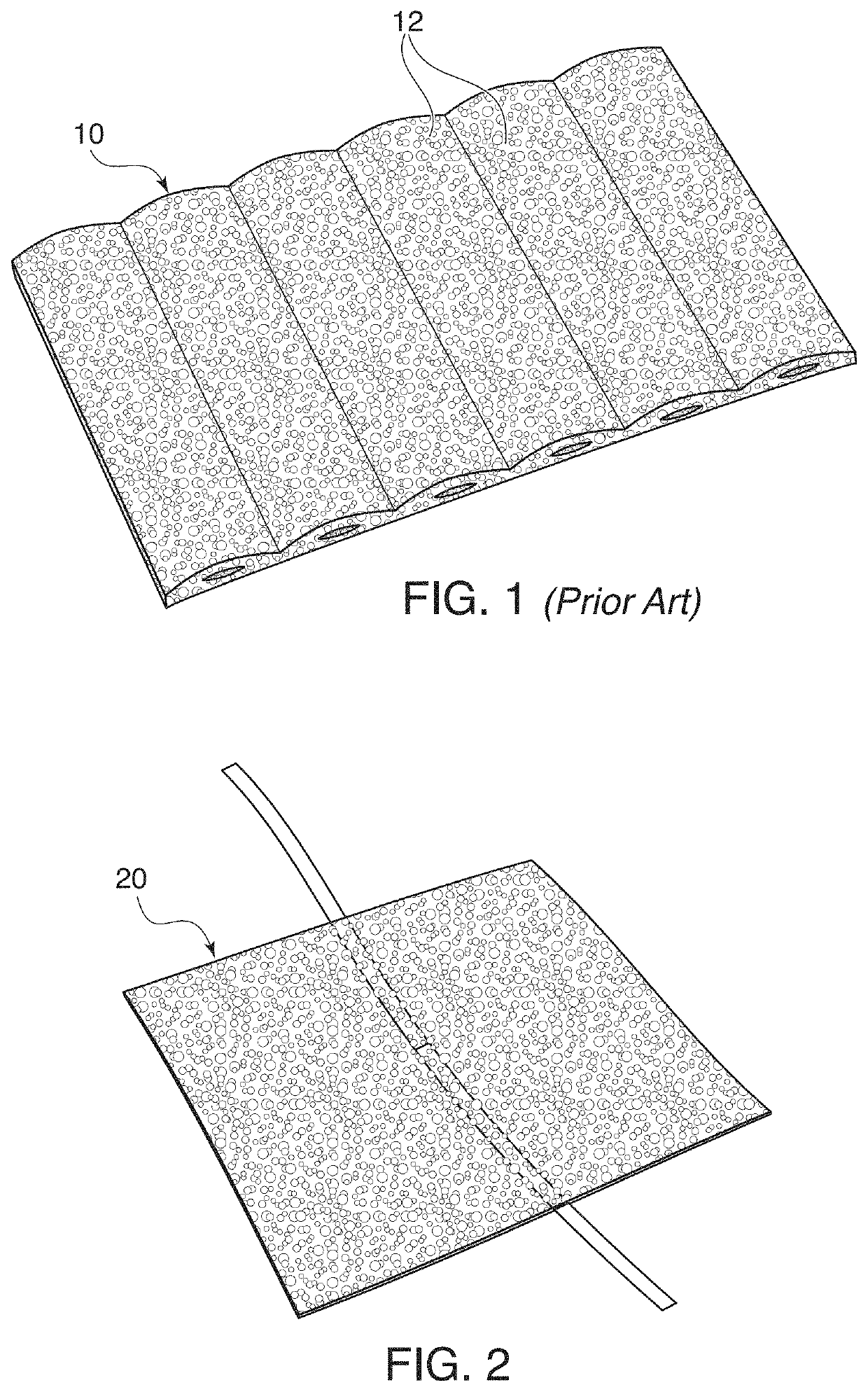 Channel implant