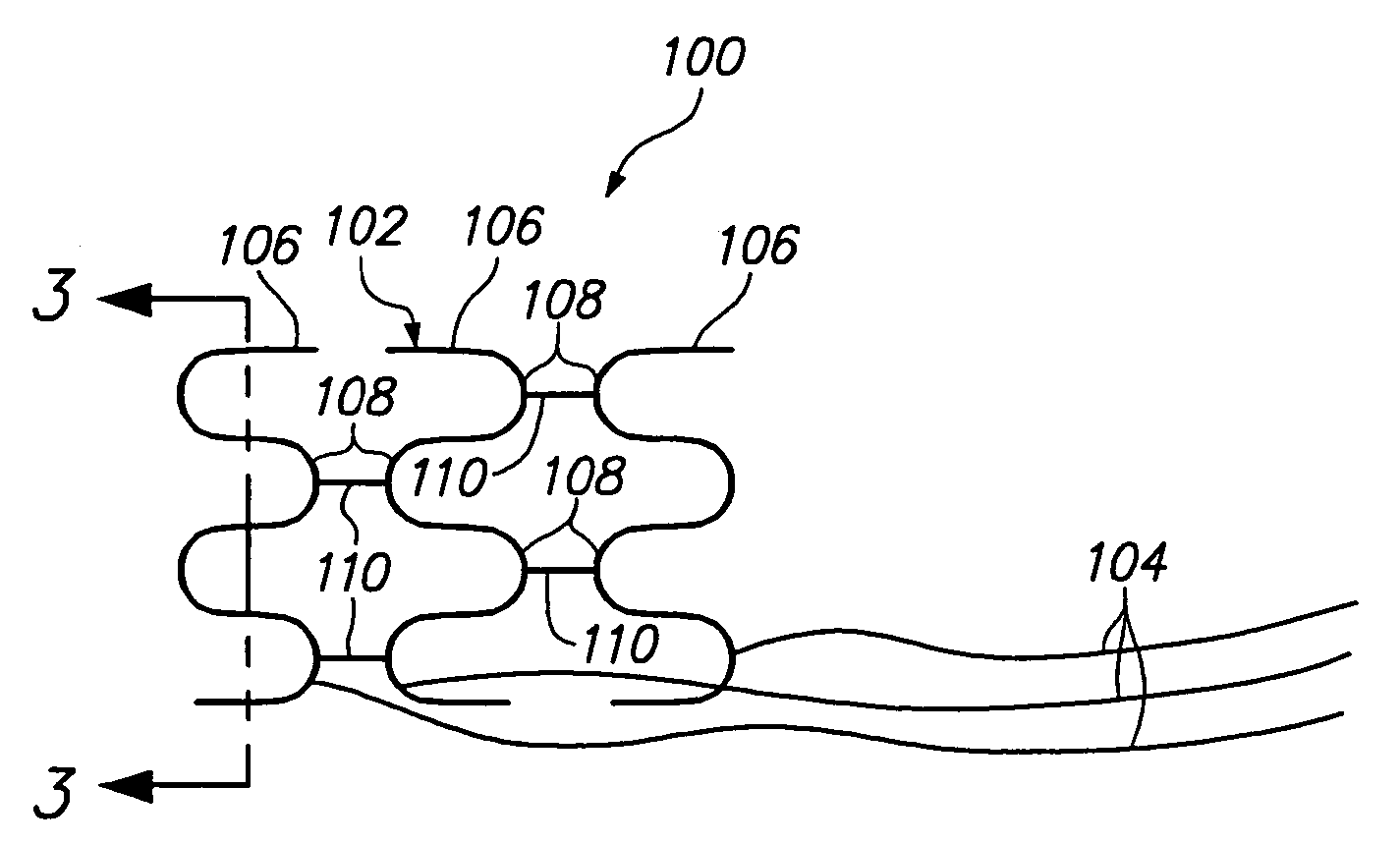 Intravascular self-anchoring electrode body with arcuate springs, spring loops, or arms