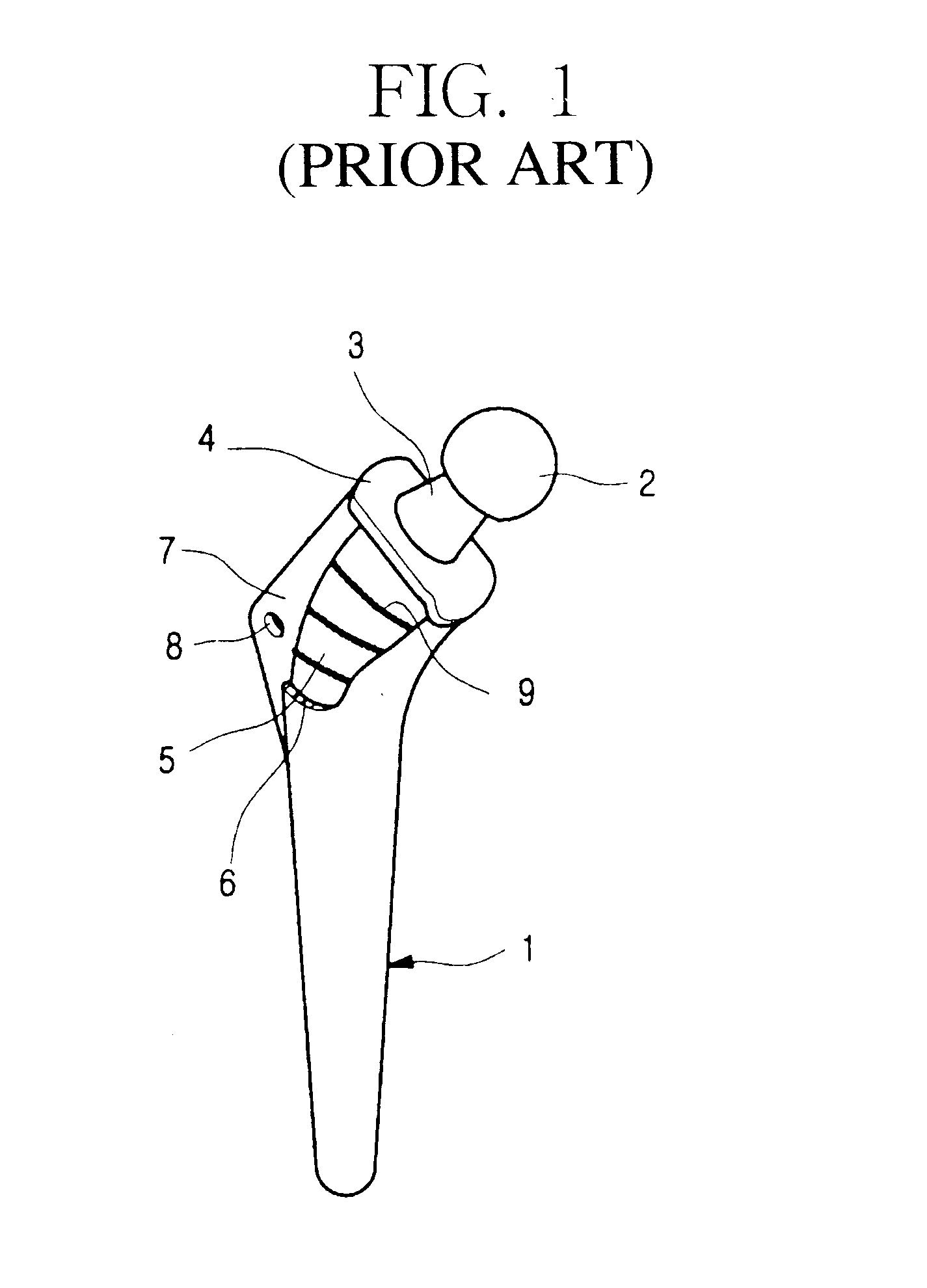 Metal jacket for a cementless artificial joint stem and artificial joint having the jacket