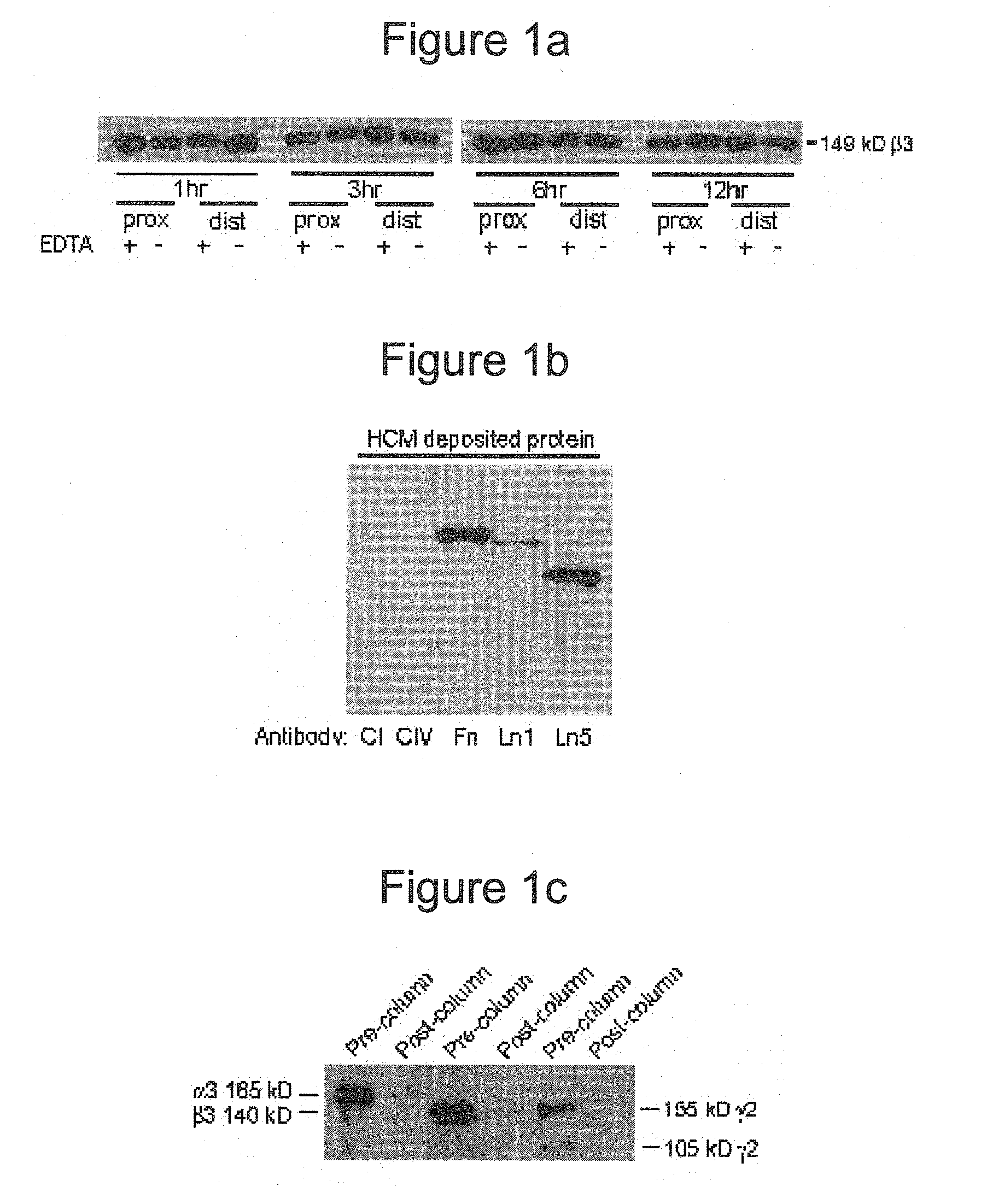 Implantable medical articles having laminin coatings and methods of use